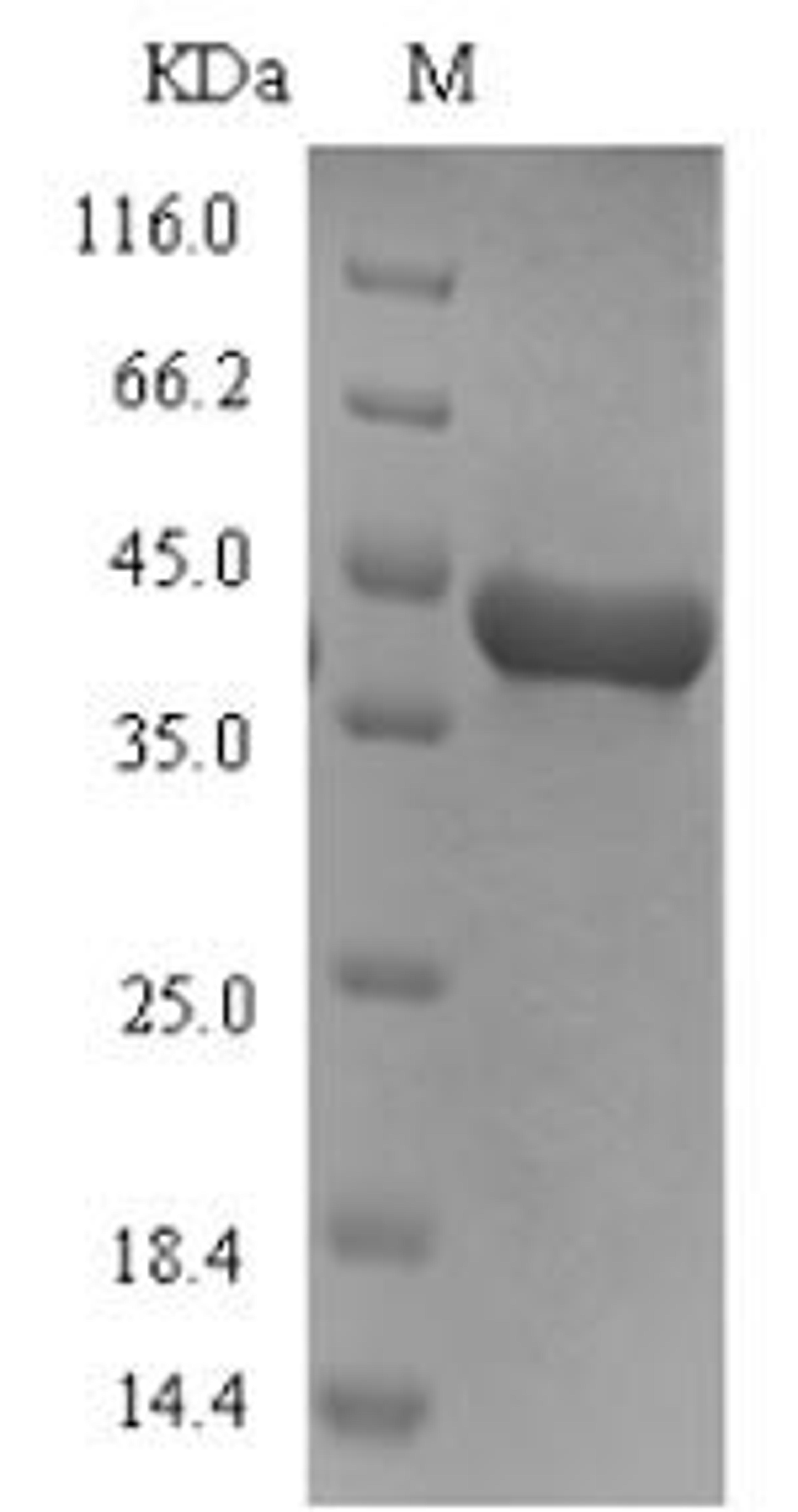(Tris-Glycine gel) Discontinuous SDS-PAGE (reduced) with 5% enrichment gel and 15% separation gel.