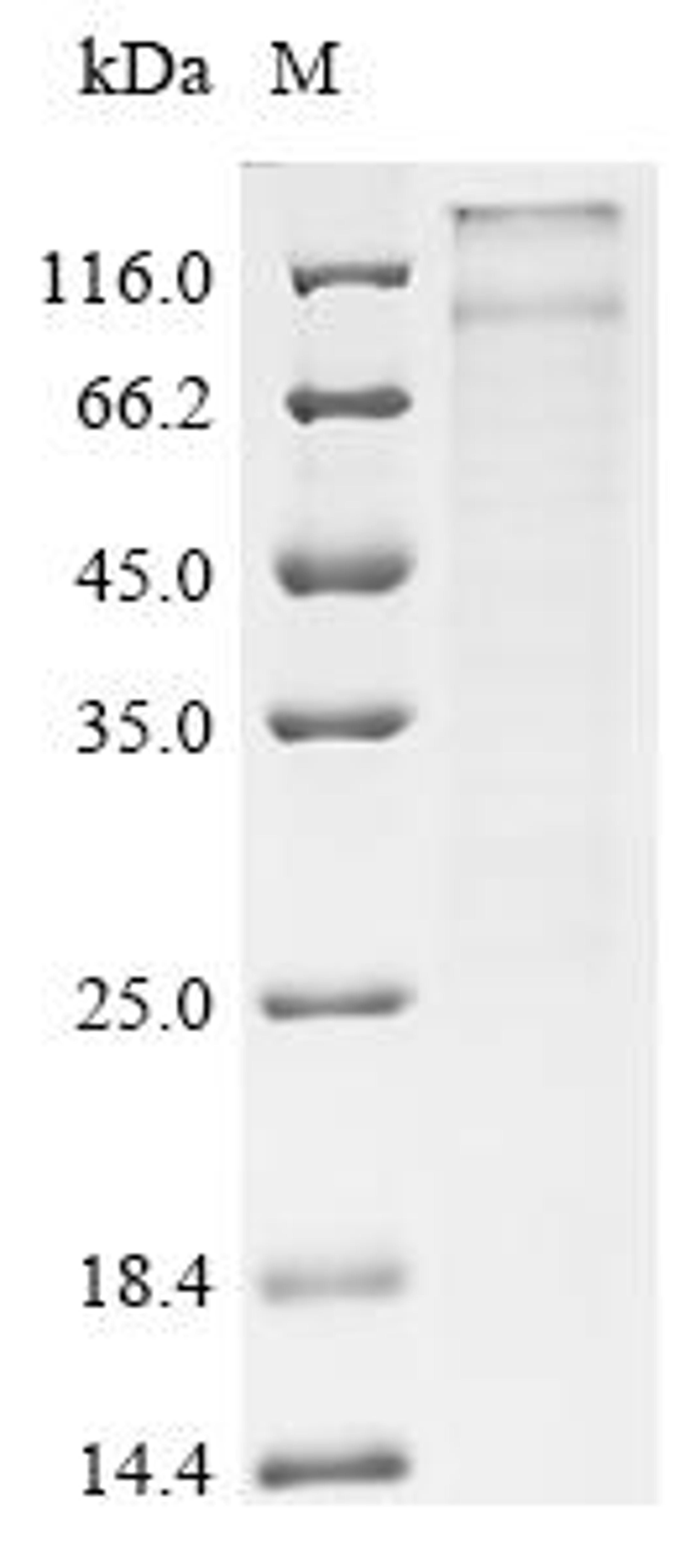(Tris-Glycine gel) Discontinuous SDS-PAGE (reduced) with 5% enrichment gel and 15% separation gel.