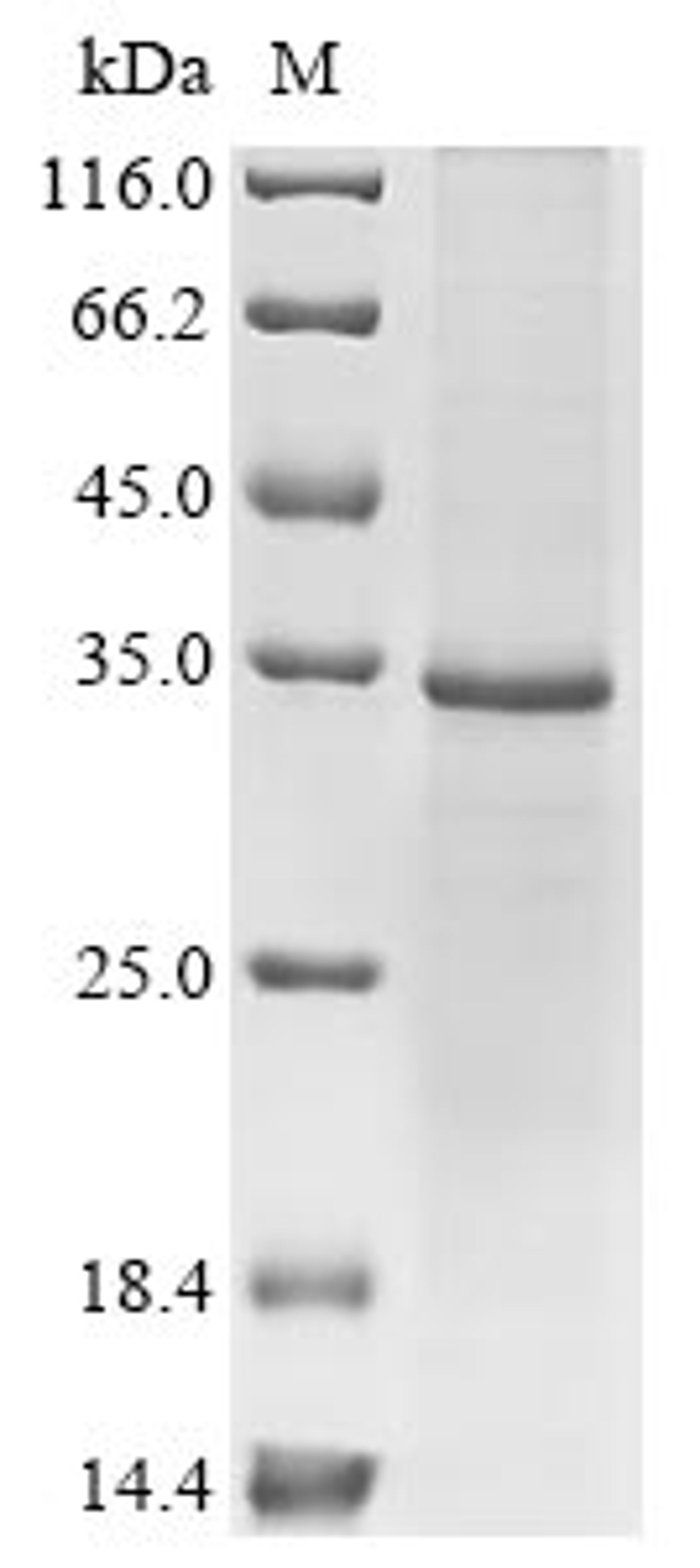 (Tris-Glycine gel) Discontinuous SDS-PAGE (reduced) with 5% enrichment gel and 15% separation gel.