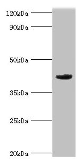 Western blot. All lanes: Mortality factor 4-like protein 1 antibody at 2ug/ml + A549 whole cell lysate. Secondary. Goat polyclonal to rabbit IgG at 1/10000 dilution. Predicted band size: 42, 38, 27 kDa. Observed band size: 42 kDa. 
