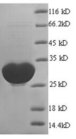 (Tris-Glycine gel) Discontinuous SDS-PAGE (reduced) with 5% enrichment gel and 15% separation gel.