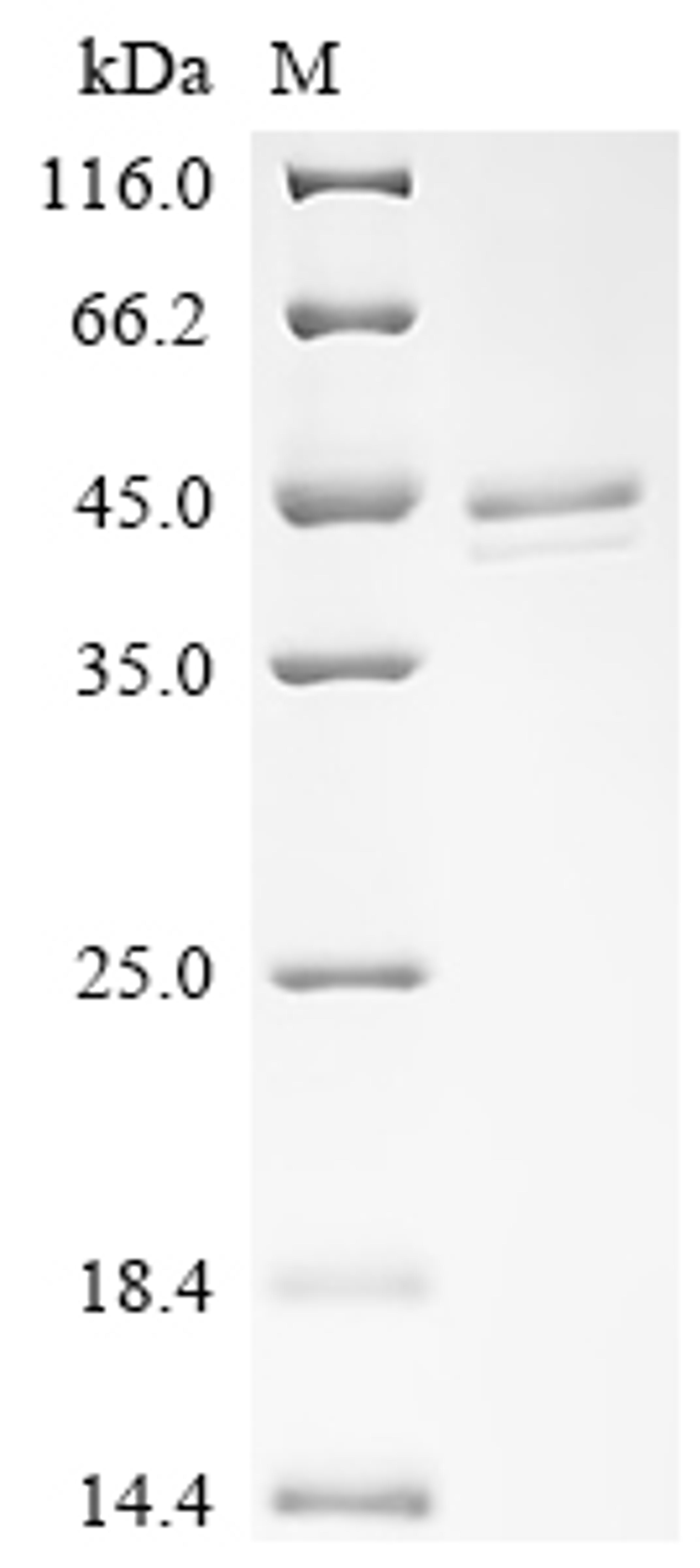 (Tris-Glycine gel) Discontinuous SDS-PAGE (reduced) with 5% enrichment gel and 15% separation gel.