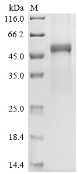 (Tris-Glycine gel) Discontinuous SDS-PAGE (reduced) with 5% enrichment gel and 15% separation gel.