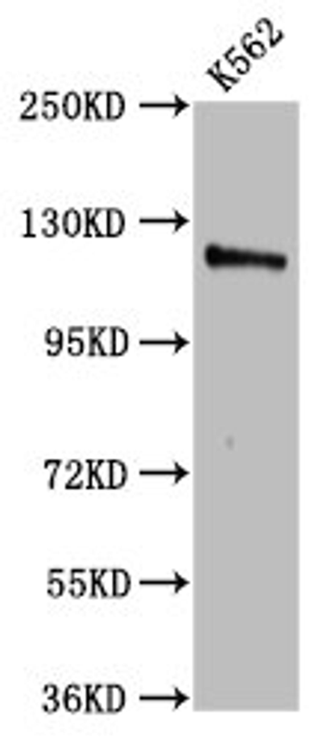 Western Blot. Positive WB detected in: K562 whole cell lysate. All lanes: CENPJ antibody at 3.2µg/ml. Secondary. Goat polyclonal to rabbit IgG at 1/50000 dilution. Predicted band size: 154, 125 kDa. Observed band size: 125 kDa