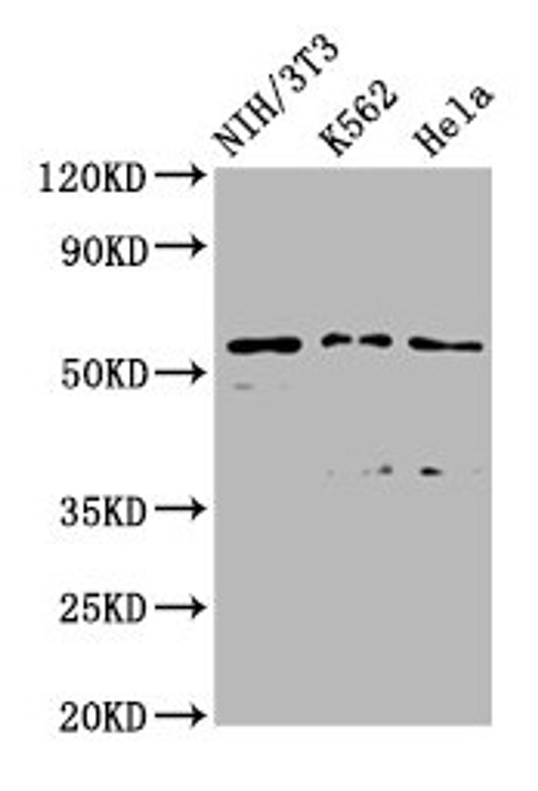 Western Blot. Positive WB detected in: NIH/3T3 whole cell lysate, K562 whole cell lysate, Hela whole cell lysate. All lanes: TTC26 antibody at 2.45µg/ml. Secondary. Goat polyclonal to rabbit IgG at 1/50000 dilution. Predicted band size: 65, 57, 61 kDa. Observed band size: 57 kDa