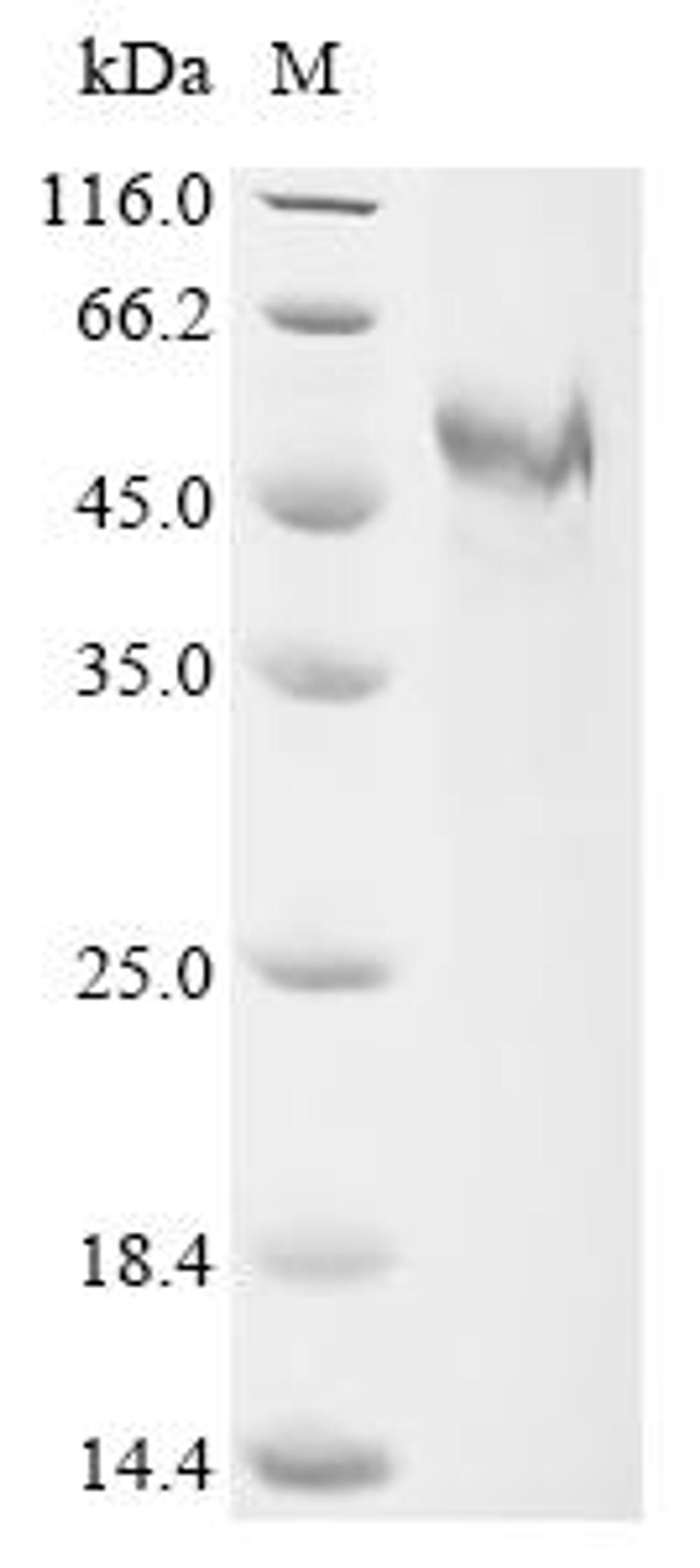 (Tris-Glycine gel) Discontinuous SDS-PAGE (reduced) with 5% enrichment gel and 15% separation gel.
