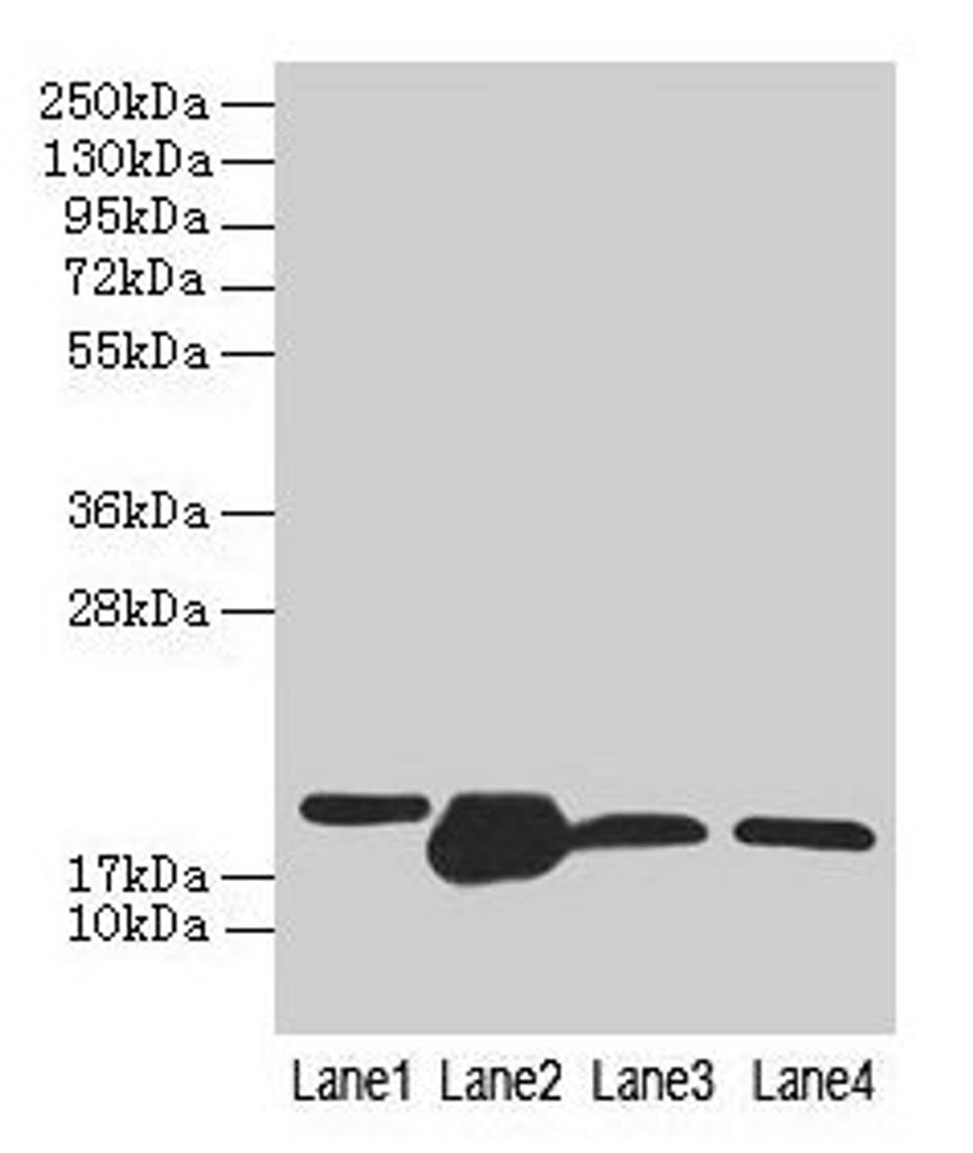 Western blot. All lanes: DHRS3 antibody at 0.8µg/ml. Lane 1: A375 whole cell lysate. Lane 2: Mouse liver tissue. Lane 3: Mouse spleen tissue. Lane 4: HL60 whole cell lysate. Secondary. Goat polyclonal to rabbit IgG at 1/10000 dilution. Predicted band size: 34, 19 kDa. Observed band size: 19 kDa
