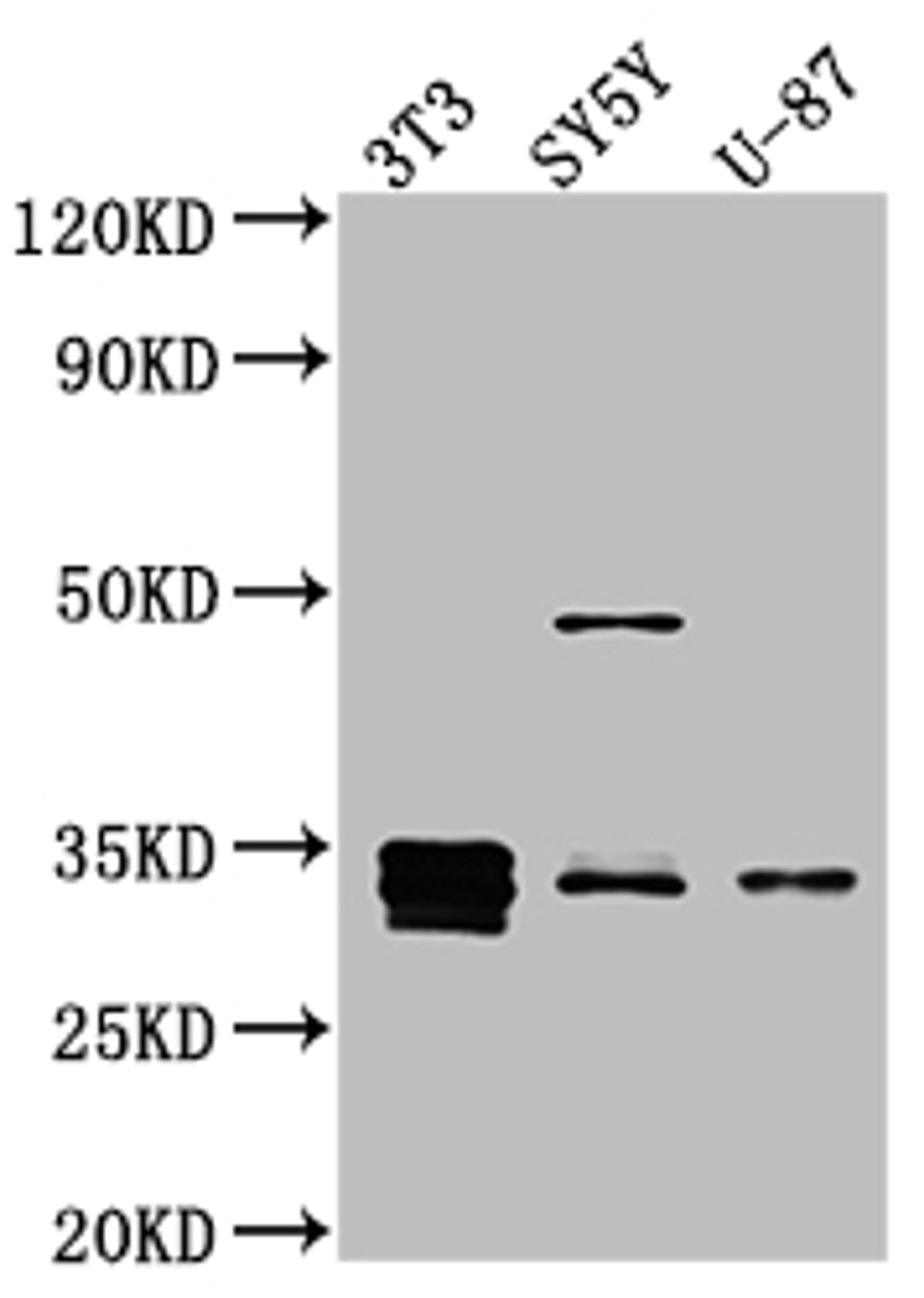Western Blot. Positive WB detected in: NIH/3T3 whole cell lysate, SH-SY5Y whole cell lysate, U-87 whole cell lysate. All lanes: Cyclin D1 antibody at 1:1000. Secondary. Goat polyclonal to rabbit IgG at 1/50000 dilution. Predicted band size: 34 kDa. Observed band size: 34 kDa. 
