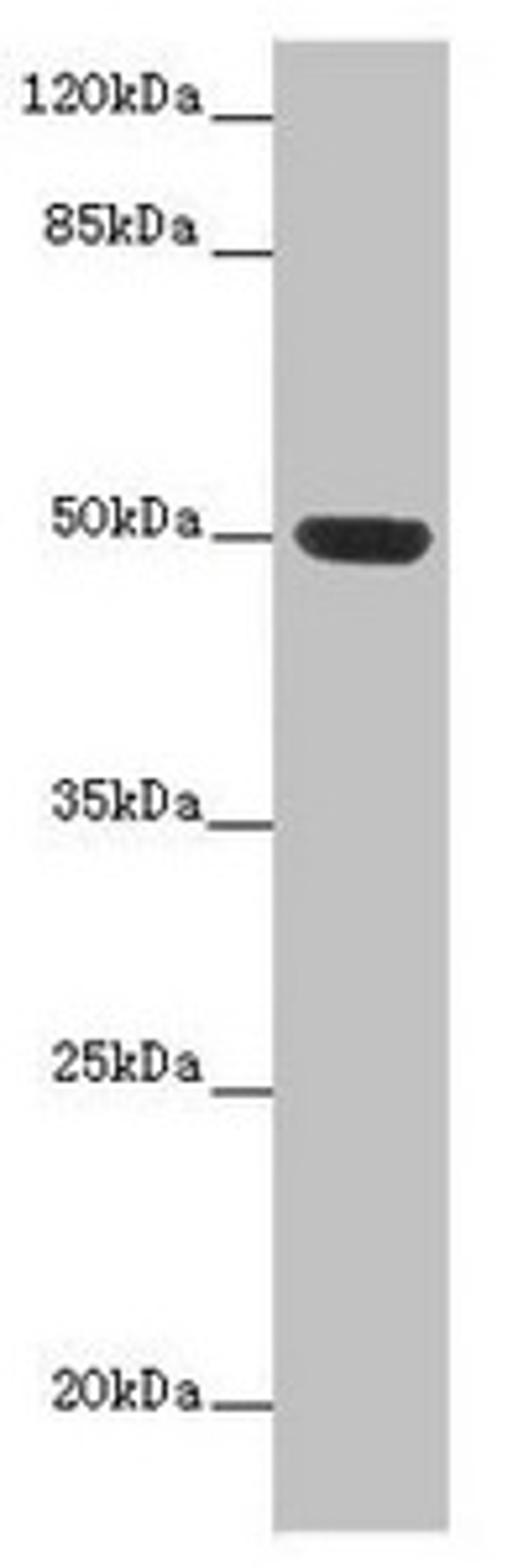 Western blot. All lanes: HTR3D antibody at 2µg/ml + Hela whole cell lysate. Secondary. Goat polyclonal to rabbit IgG at 1/10000 dilution. Predicted band size: 51, 31, 26, 46 kDa. Observed band size: 51 kDa