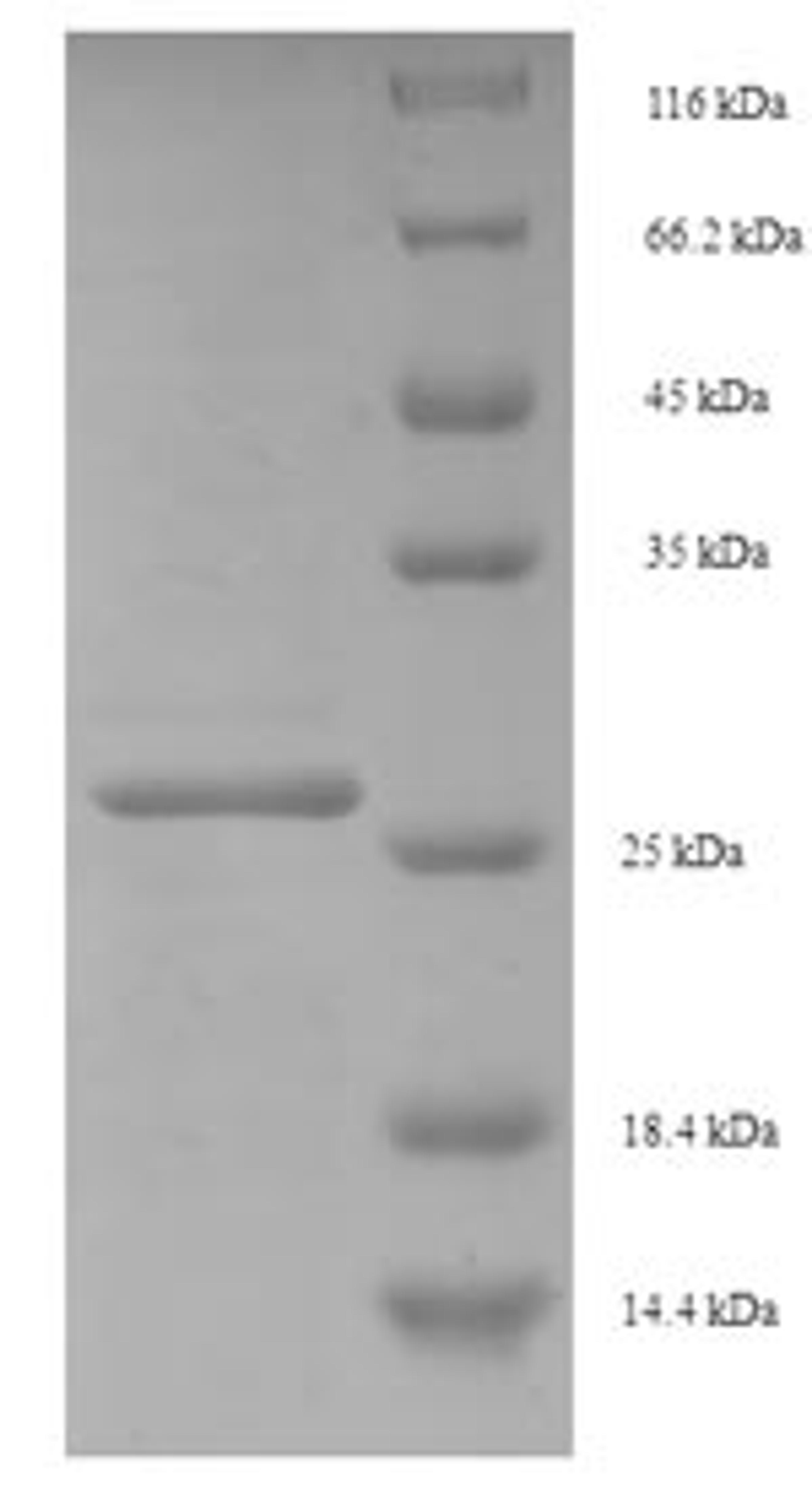 (Tris-Glycine gel) Discontinuous SDS-PAGE (reduced) with 5% enrichment gel and 15% separation gel.
