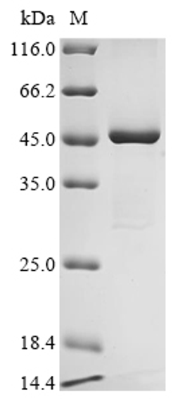 (Tris-Glycine gel) Discontinuous SDS-PAGE (reduced) with 5% enrichment gel and 15% separation gel.