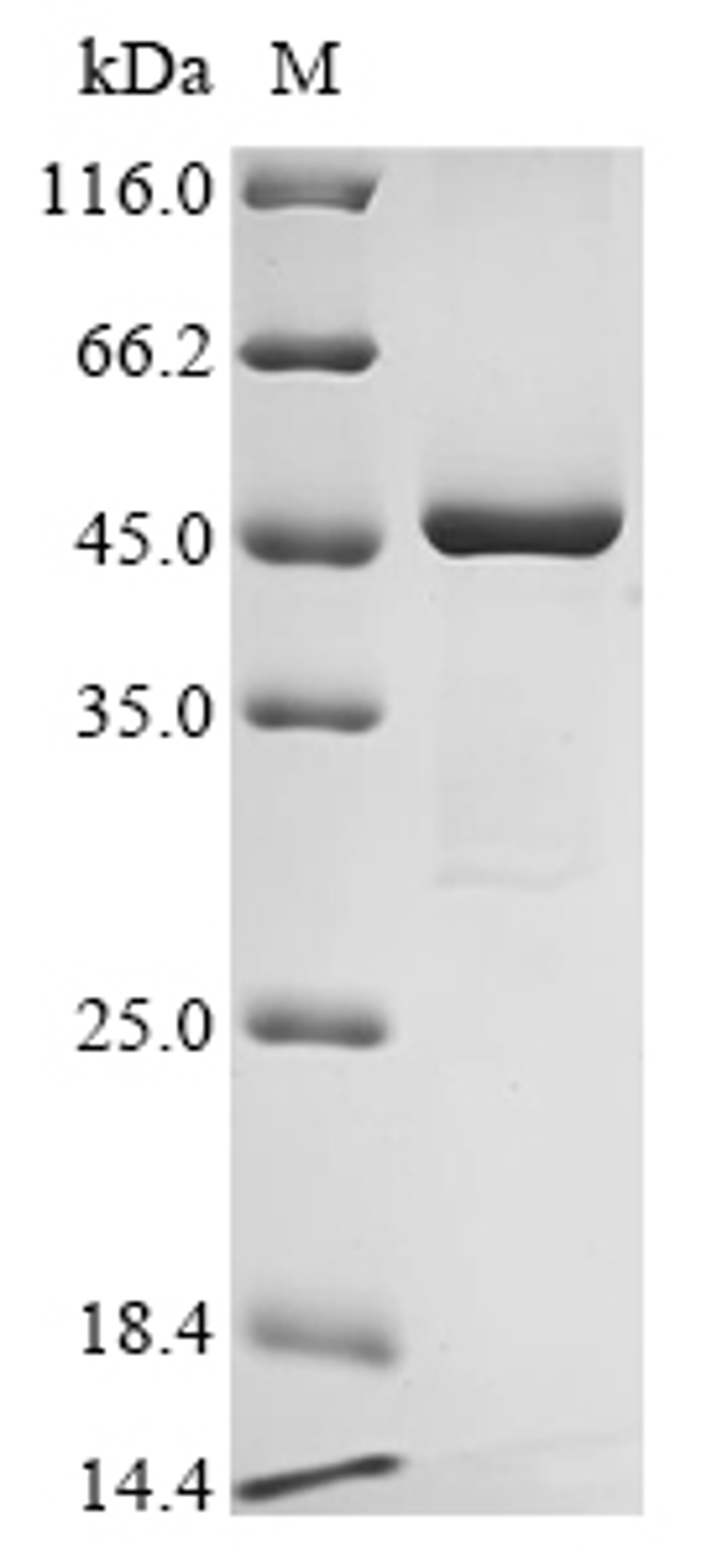 (Tris-Glycine gel) Discontinuous SDS-PAGE (reduced) with 5% enrichment gel and 15% separation gel.