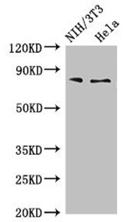 Western Blot. Positive WB detected in: NIH/3T3 whole cell lysate, Hela whole cell lysate. All lanes: PCCA antibody at 4µg/ml. Secondary. Goat polyclonal to rabbit IgG at 1/50000 dilution. Predicted band size: 81, 78, 76 kDa. Observed band size: 81 kDa