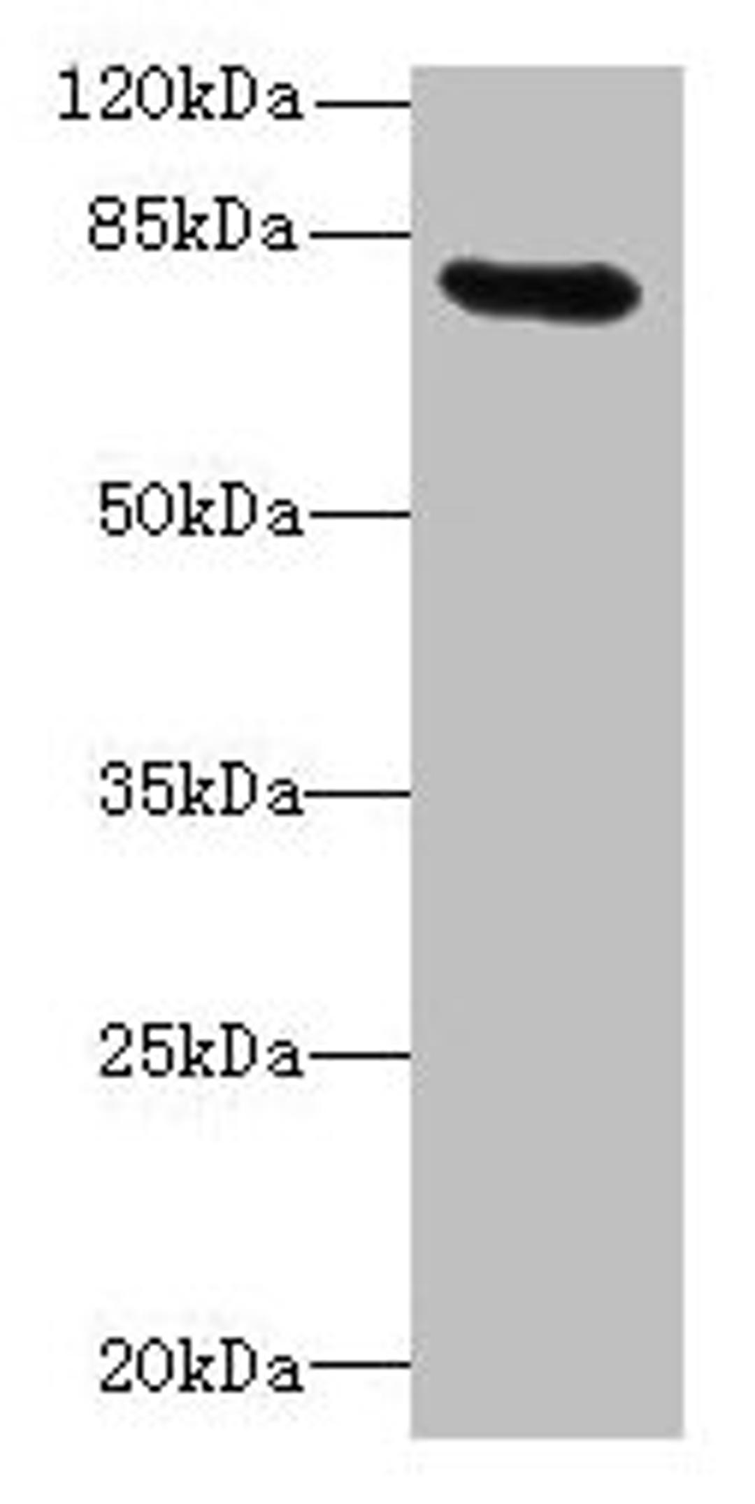 Western blot. All lanes: RAD17 antibody at 12µg/ml + Mouse thymus tissue. Secondary. Goat polyclonal to rabbit IgG at 1/10000 dilution. Predicted band size: 78, 76, 58, 67 kDa. Observed band size: 78 kDa