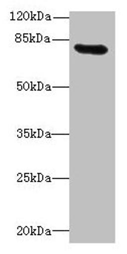 Western blot. All lanes: RAD17 antibody at 12µg/ml + Mouse thymus tissue. Secondary. Goat polyclonal to rabbit IgG at 1/10000 dilution. Predicted band size: 78, 76, 58, 67 kDa. Observed band size: 78 kDa