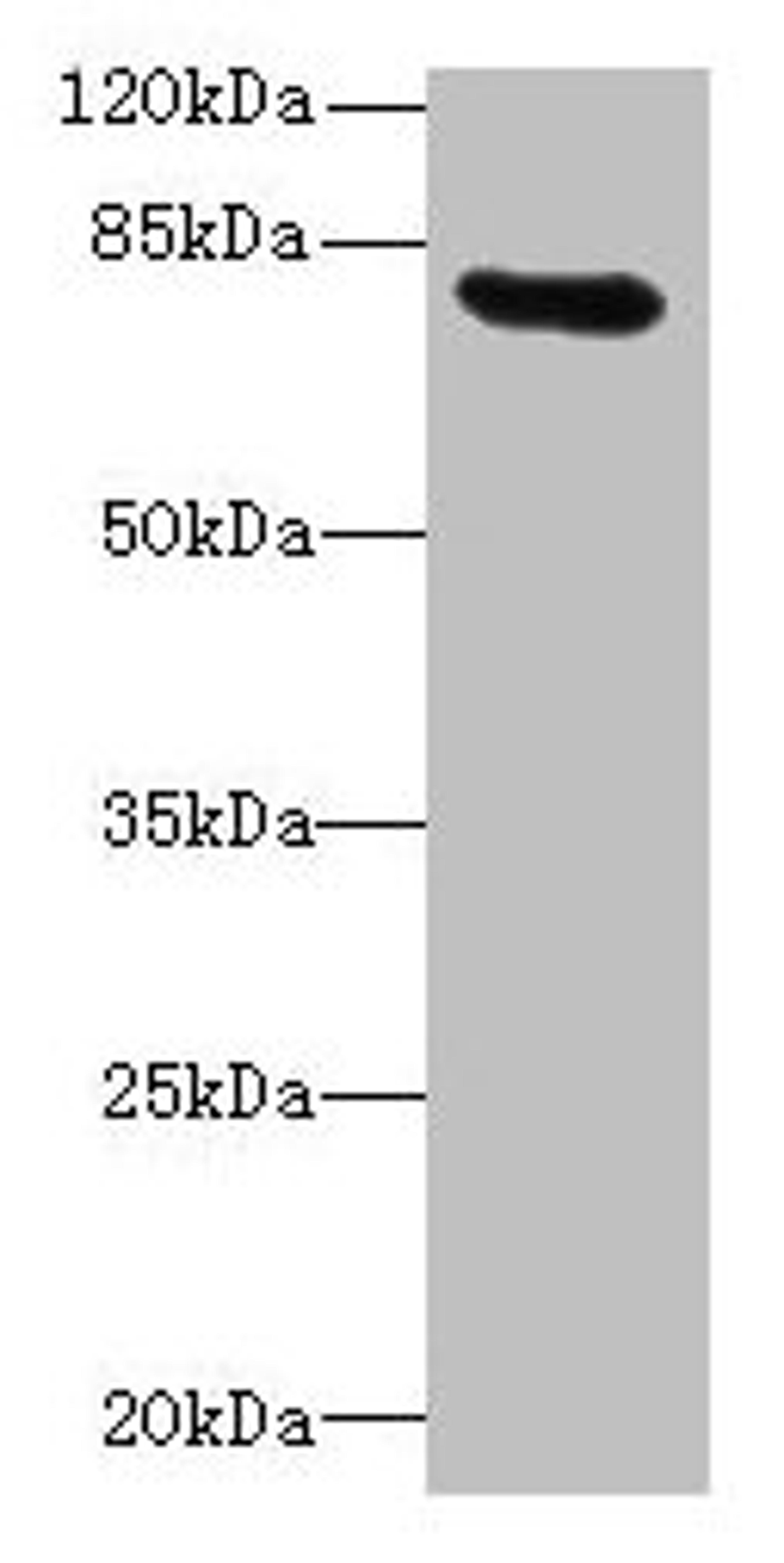 Western blot. All lanes: RAD17 antibody at 12µg/ml + Mouse thymus tissue. Secondary. Goat polyclonal to rabbit IgG at 1/10000 dilution. Predicted band size: 78, 76, 58, 67 kDa. Observed band size: 78 kDa