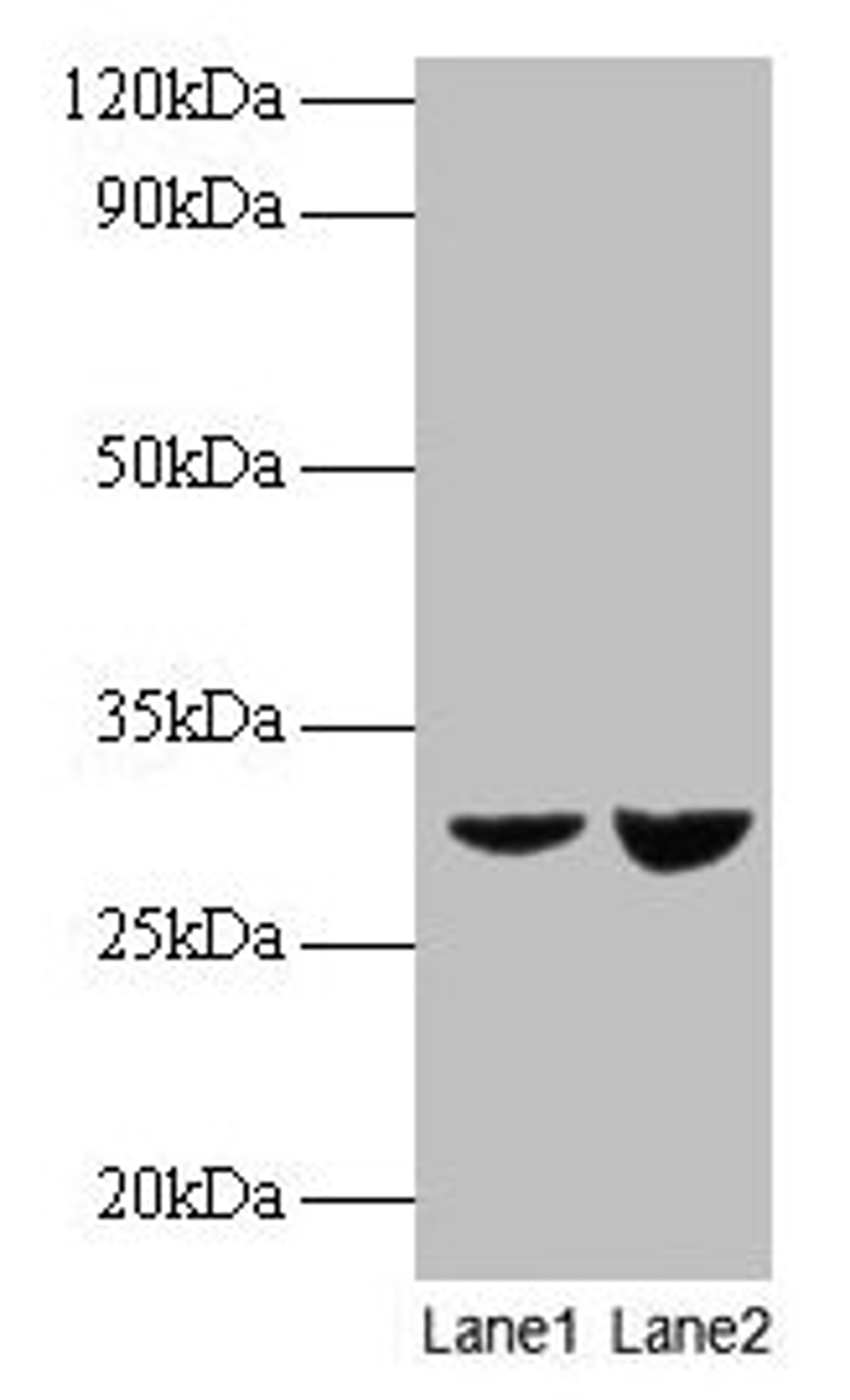 Western blot. All lanes: UQCRFS1 antibody at 2µg/ml. Lane 1: EC109 whole cell lysate. Lane 2: 293T whole cell lysate. Secondary. Goat polyclonal to rabbit IgG at 1/15000 dilution. Predicted band size: 30 kDa. Observed band size: 30 kDa