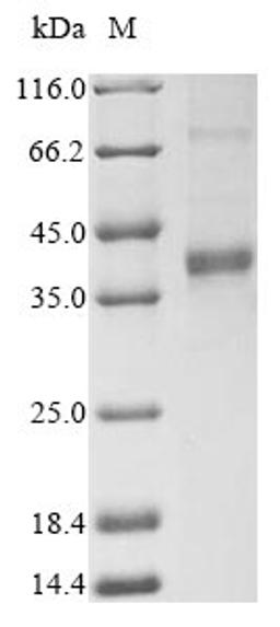 (Tris-Glycine gel) Discontinuous SDS-PAGE (reduced) with 5% enrichment gel and 15% separation gel.