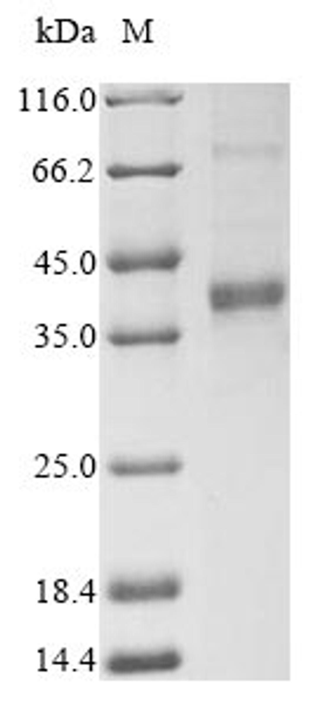 (Tris-Glycine gel) Discontinuous SDS-PAGE (reduced) with 5% enrichment gel and 15% separation gel.