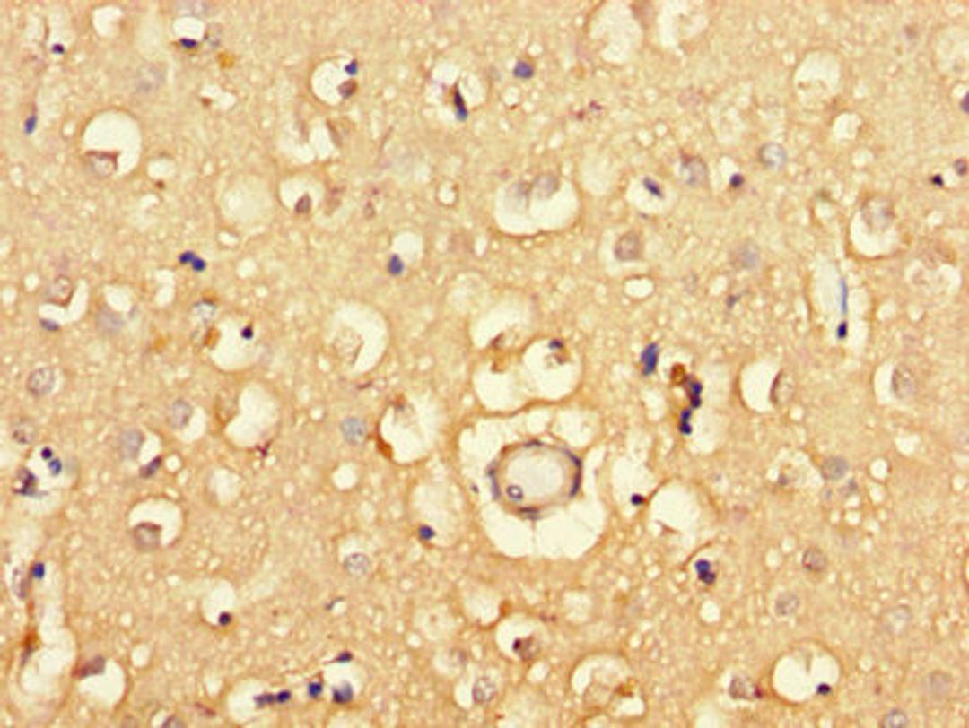 Immunohistochemistry of paraffin-embedded human brain tissue using CSB-PA883397LA01HU at dilution of 1:100