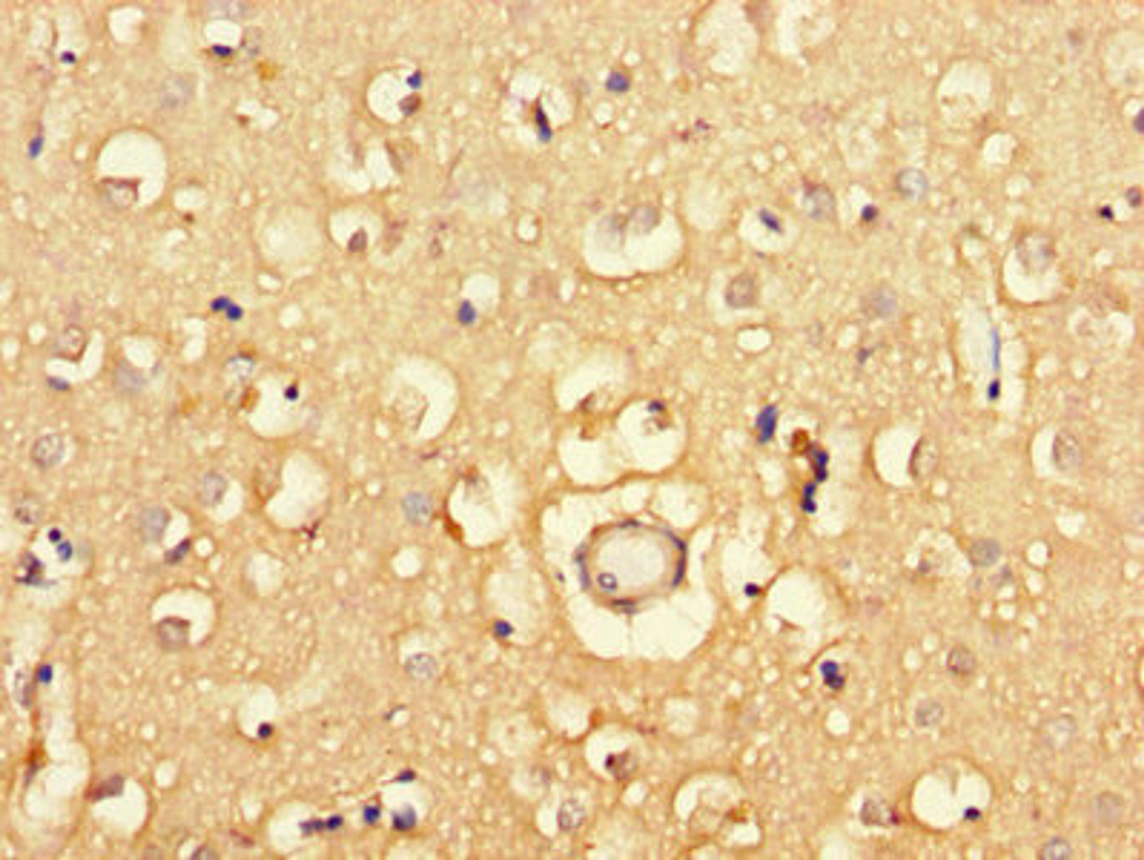 Immunohistochemistry of paraffin-embedded human brain tissue using CSB-PA883397LA01HU at dilution of 1:100