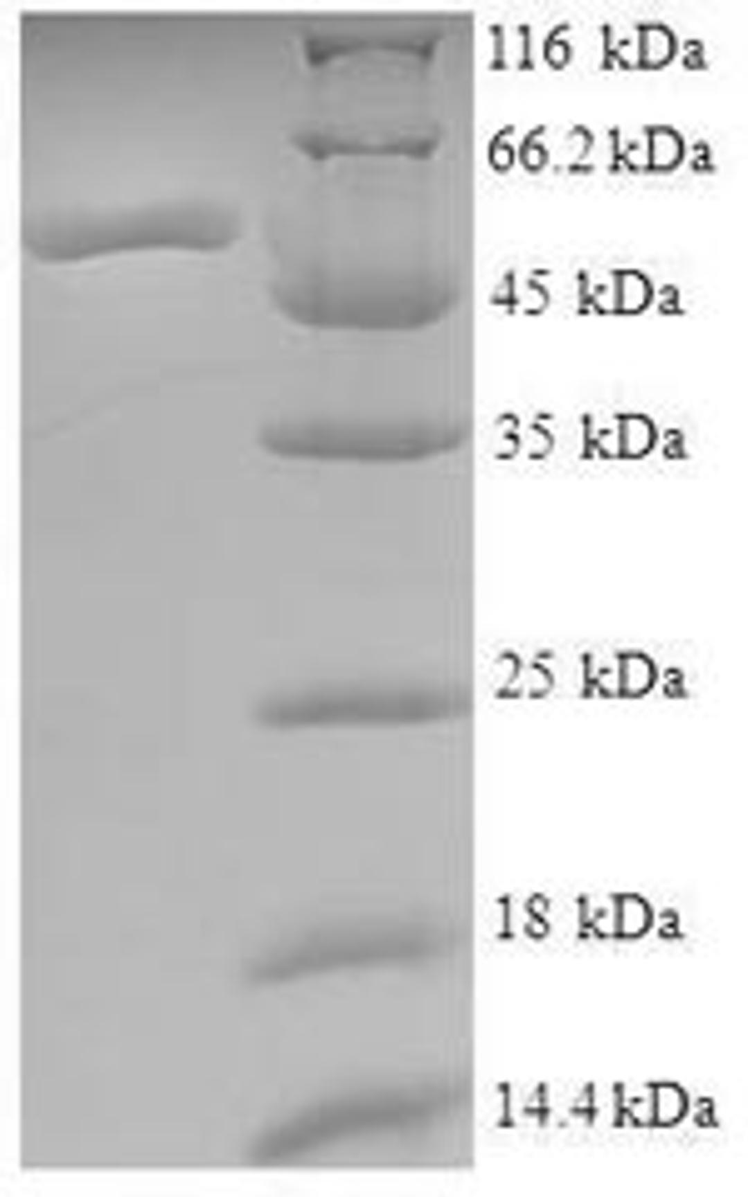 (Tris-Glycine gel) Discontinuous SDS-PAGE (reduced) with 5% enrichment gel and 15% separation gel.