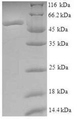 (Tris-Glycine gel) Discontinuous SDS-PAGE (reduced) with 5% enrichment gel and 15% separation gel.