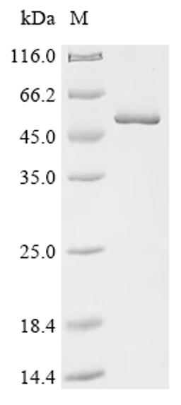 (Tris-Glycine gel) Discontinuous SDS-PAGE (reduced) with 5% enrichment gel and 15% separation gel.