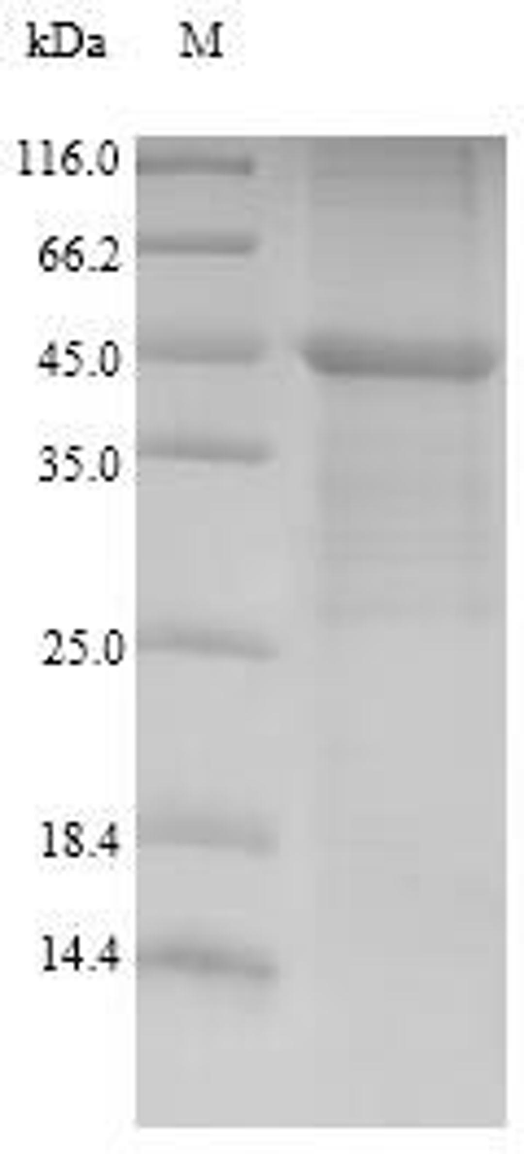 (Tris-Glycine gel) Discontinuous SDS-PAGE (reduced) with 5% enrichment gel and 15% separation gel.