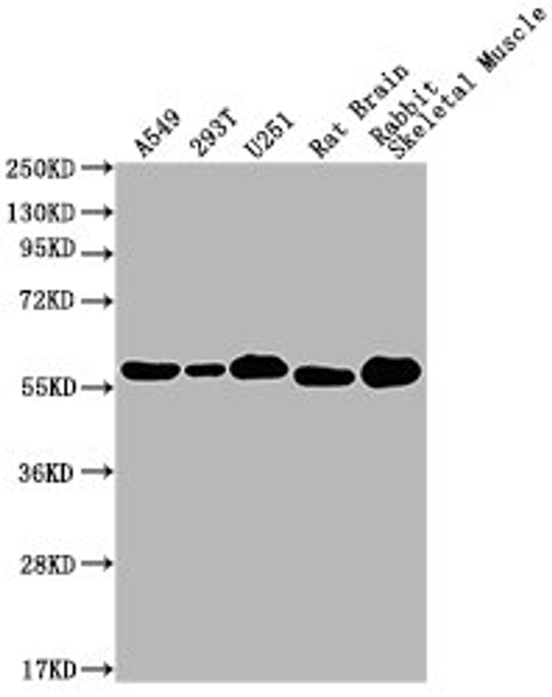 Western Blot. Positive WB detected in:  A549 whole cell lysate, 293T whole cell lysate, U251 whole cell lysate, Rat Brain tissue, Rabbit Skeletal Muscle tissue. All lanes: PKM antibody at 1:1000. Secondary. Goat polyclonal to Mouse IgG at 1/10000 dilution. Predicted band size: 58 kDa. Observed band size: 58 KDa. Exposure time: 1min