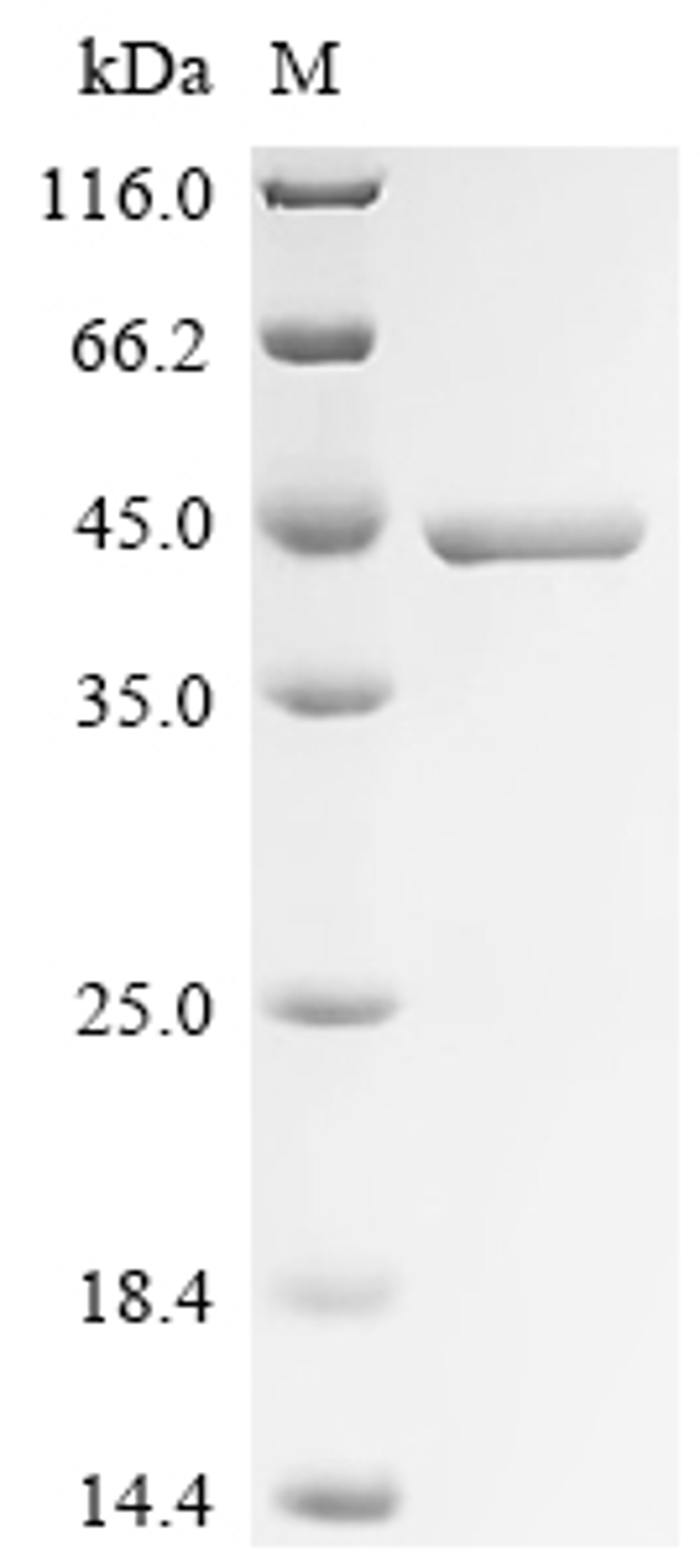 (Tris-Glycine gel) Discontinuous SDS-PAGE (reduced) with 5% enrichment gel and 15% separation gel.