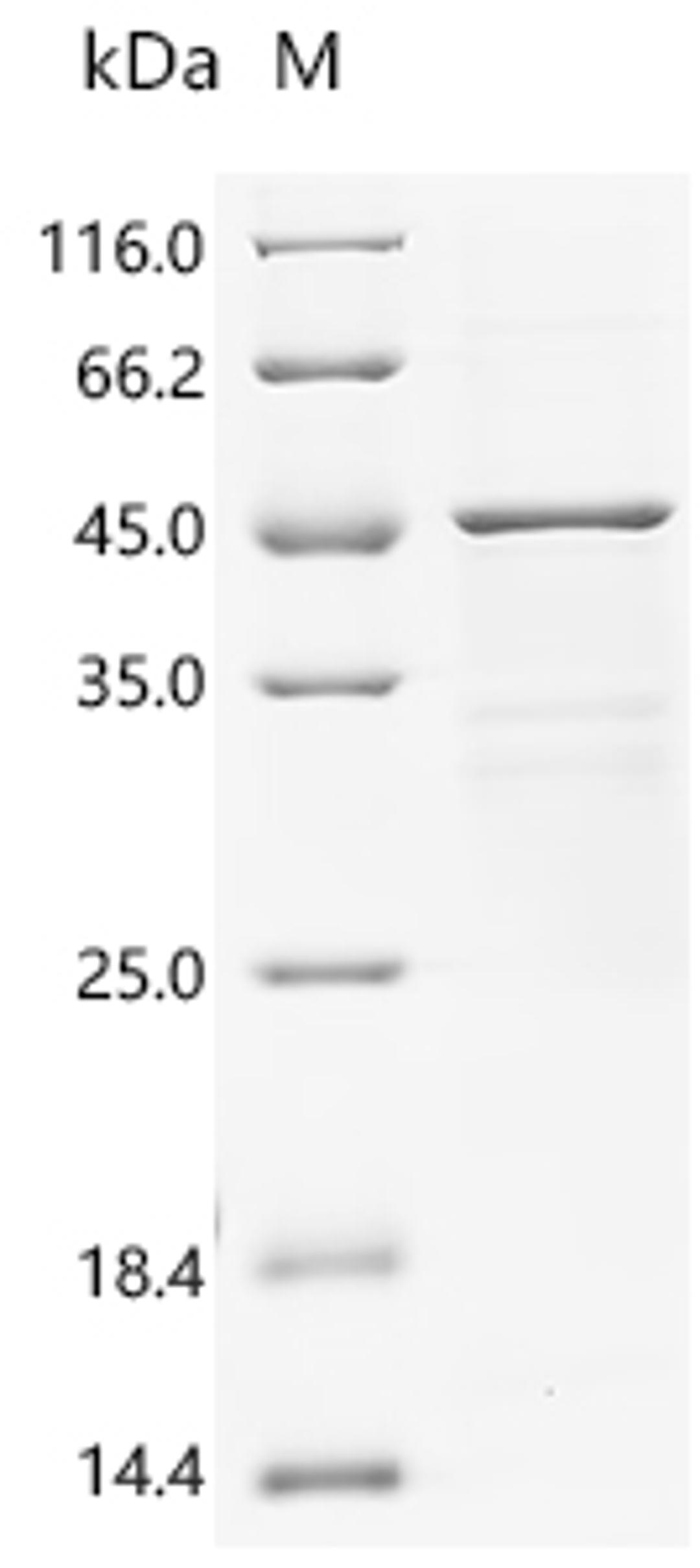 (Tris-Glycine gel) Discontinuous SDS-PAGE (reduced) with 5% enrichment gel and 15% separation gel.
