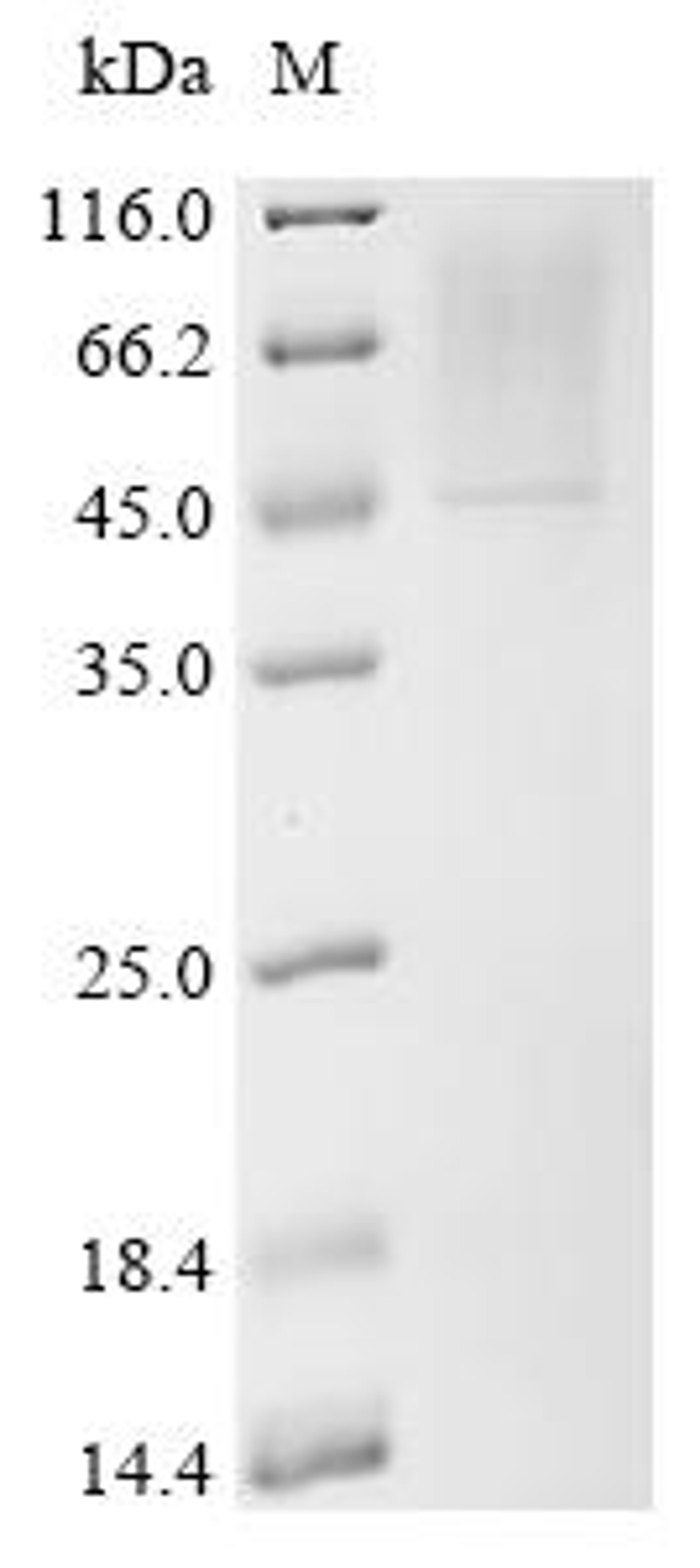 (Tris-Glycine gel) Discontinuous SDS-PAGE (reduced) with 5% enrichment gel and 15% separation gel.