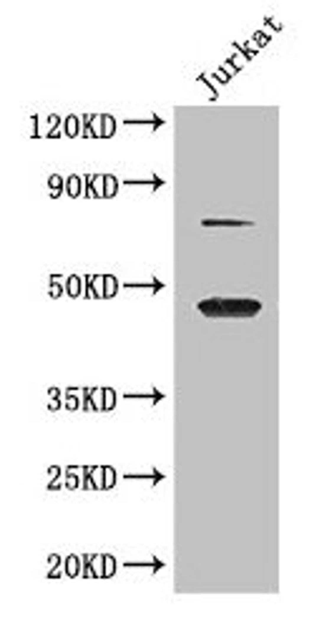 Western Blot. Positive WB detected in: Jurkat whole cell lysate. All lanes: DAZAP1 antibody at 2.8µg/ml. Secondary. Goat polyclonal to rabbit IgG at 1/50000 dilution. Predicted band size: 44, 41 kDa. Observed band size: 44, 70 kDa