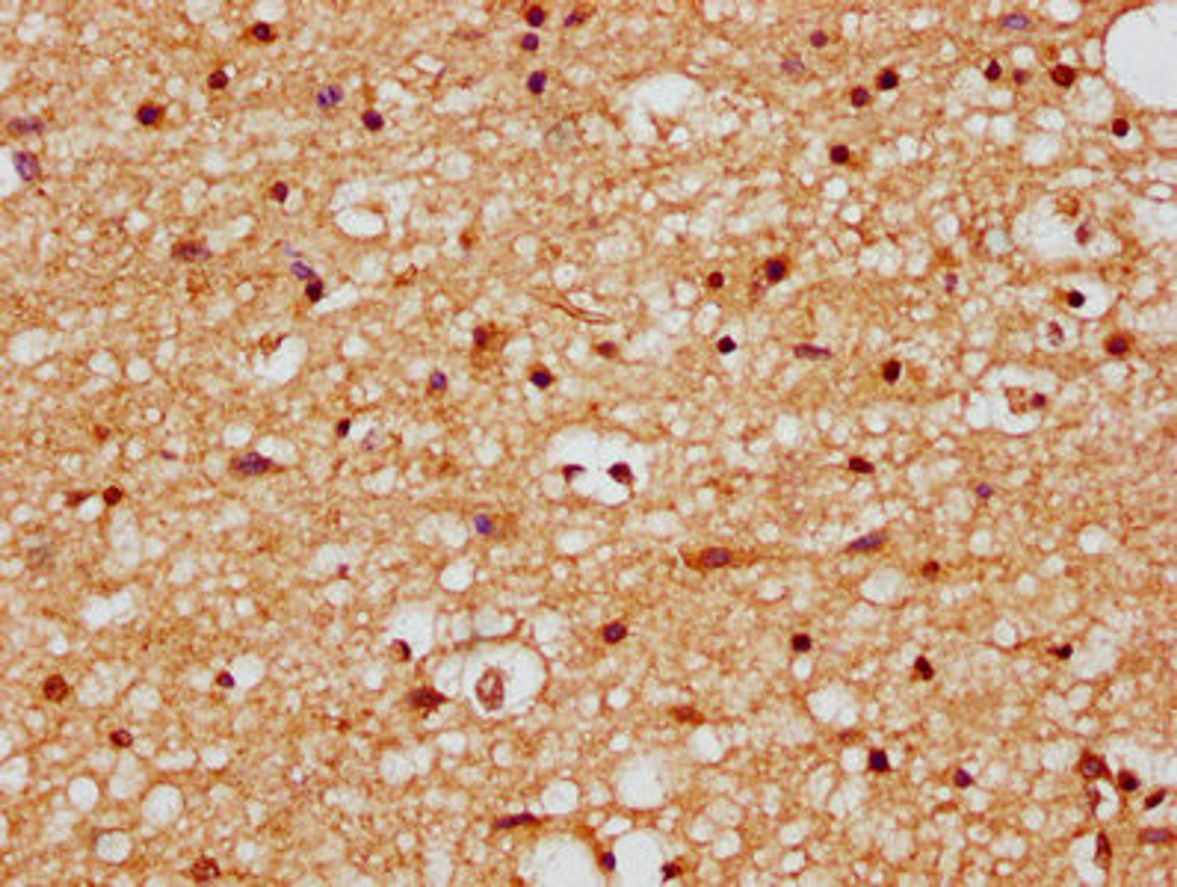 IHC image of CSB-PA897521LA01HU diluted at 1:200 and staining in paraffin-embedded human brain tissue performed on a Leica BondTM system. After dewaxing and hydration, antigen retrieval was mediated by high pressure in a citrate buffer (pH 6.0). Section was blocked with 10% normal goat serum 30min at RT. Then primary antibody (1% BSA) was incubated at 4&deg;C overnight. The primary is detected by a biotinylated secondary antibody and visualized using an HRP conjugated SP system.