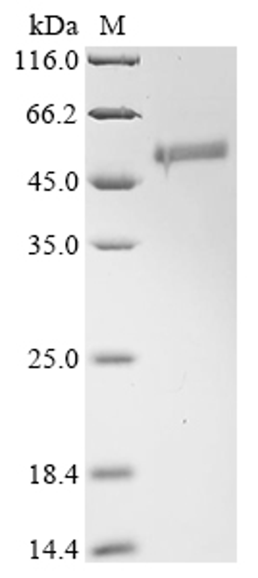 (Tris-Glycine gel) Discontinuous SDS-PAGE (reduced) with 5% enrichment gel and 15% separation gel.