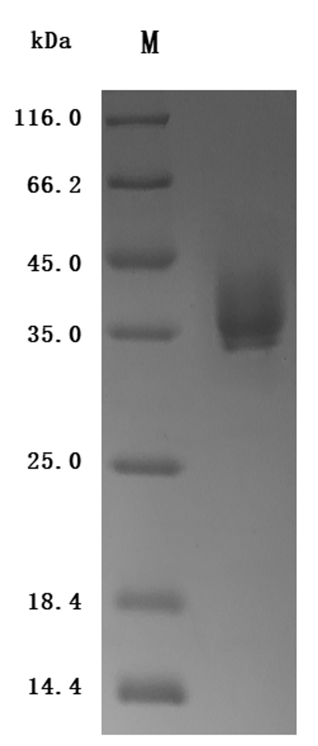 (Tris-Glycine gel) Discontinuous SDS-PAGE (reduced) with 5% enrichment gel and 15% separation gel.