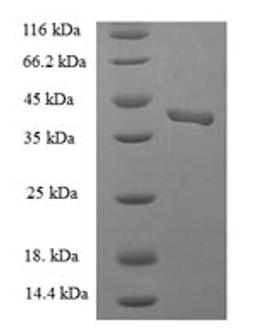 (Tris-Glycine gel) Discontinuous SDS-PAGE (reduced) with 5% enrichment gel and 15% separation gel.