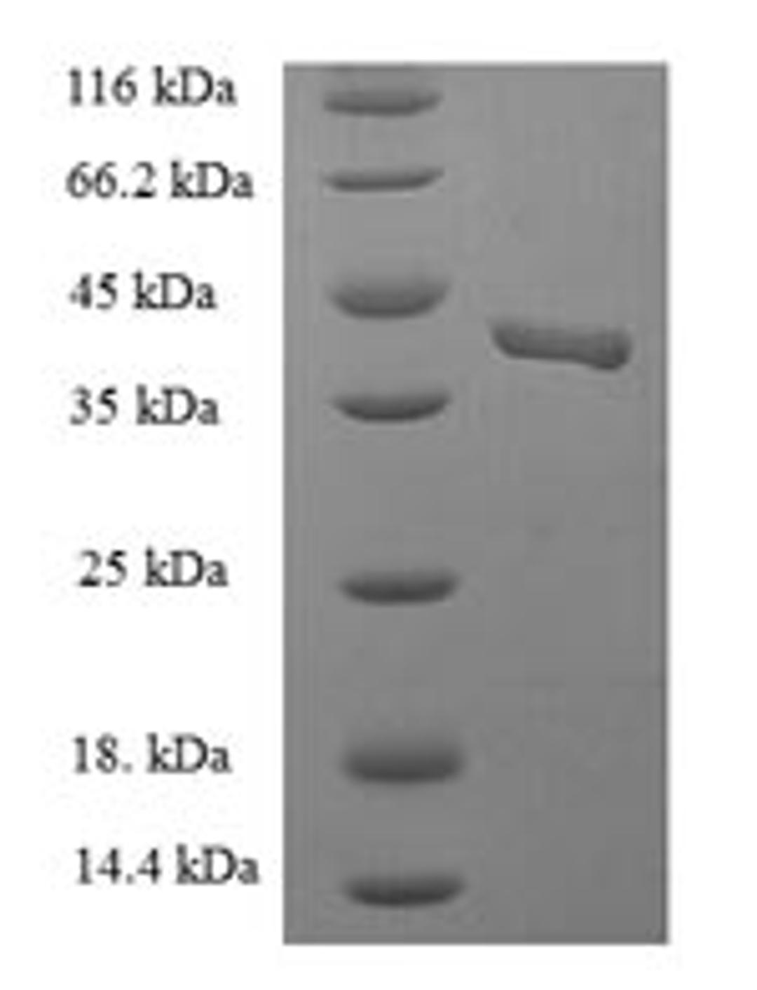 (Tris-Glycine gel) Discontinuous SDS-PAGE (reduced) with 5% enrichment gel and 15% separation gel.