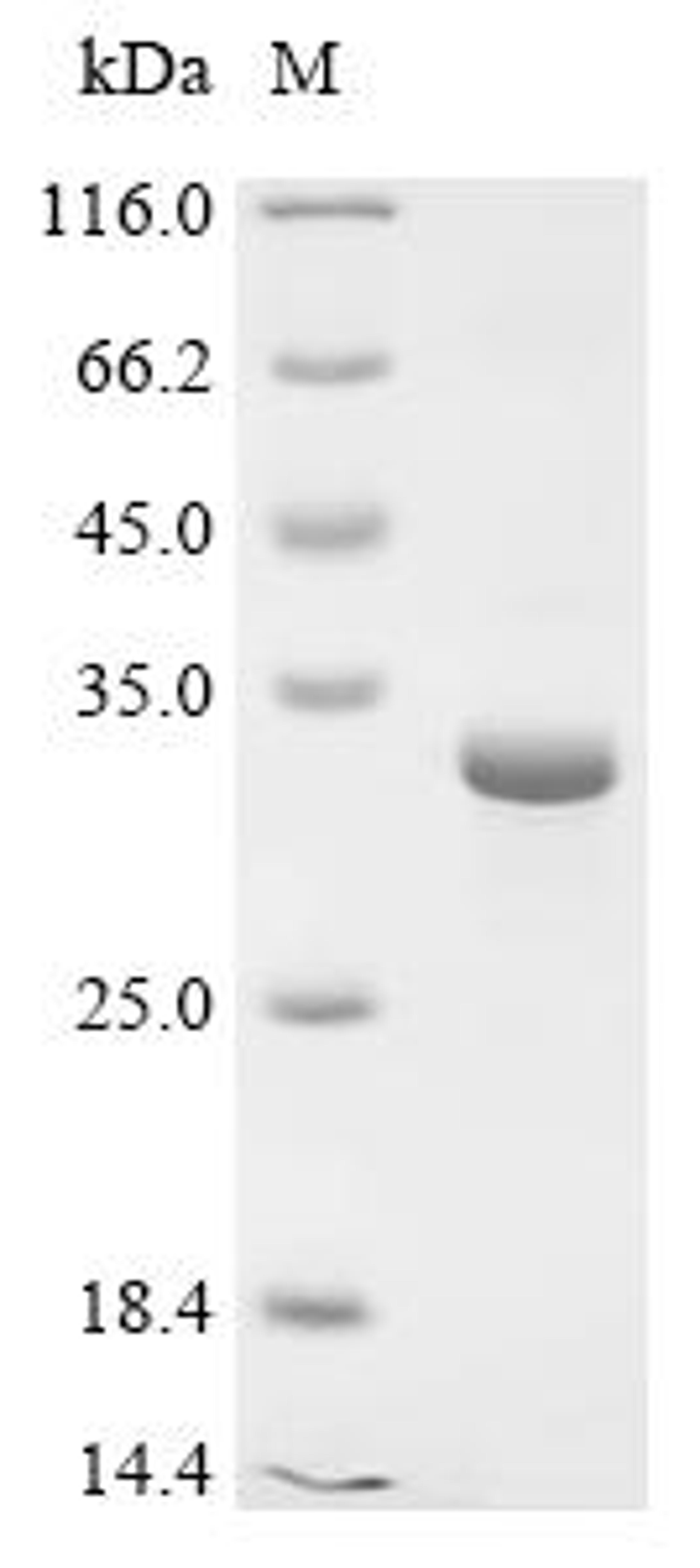 (Tris-Glycine gel) Discontinuous SDS-PAGE (reduced) with 5% enrichment gel and 15% separation gel.