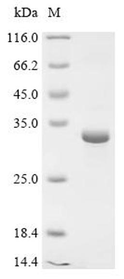 (Tris-Glycine gel) Discontinuous SDS-PAGE (reduced) with 5% enrichment gel and 15% separation gel.