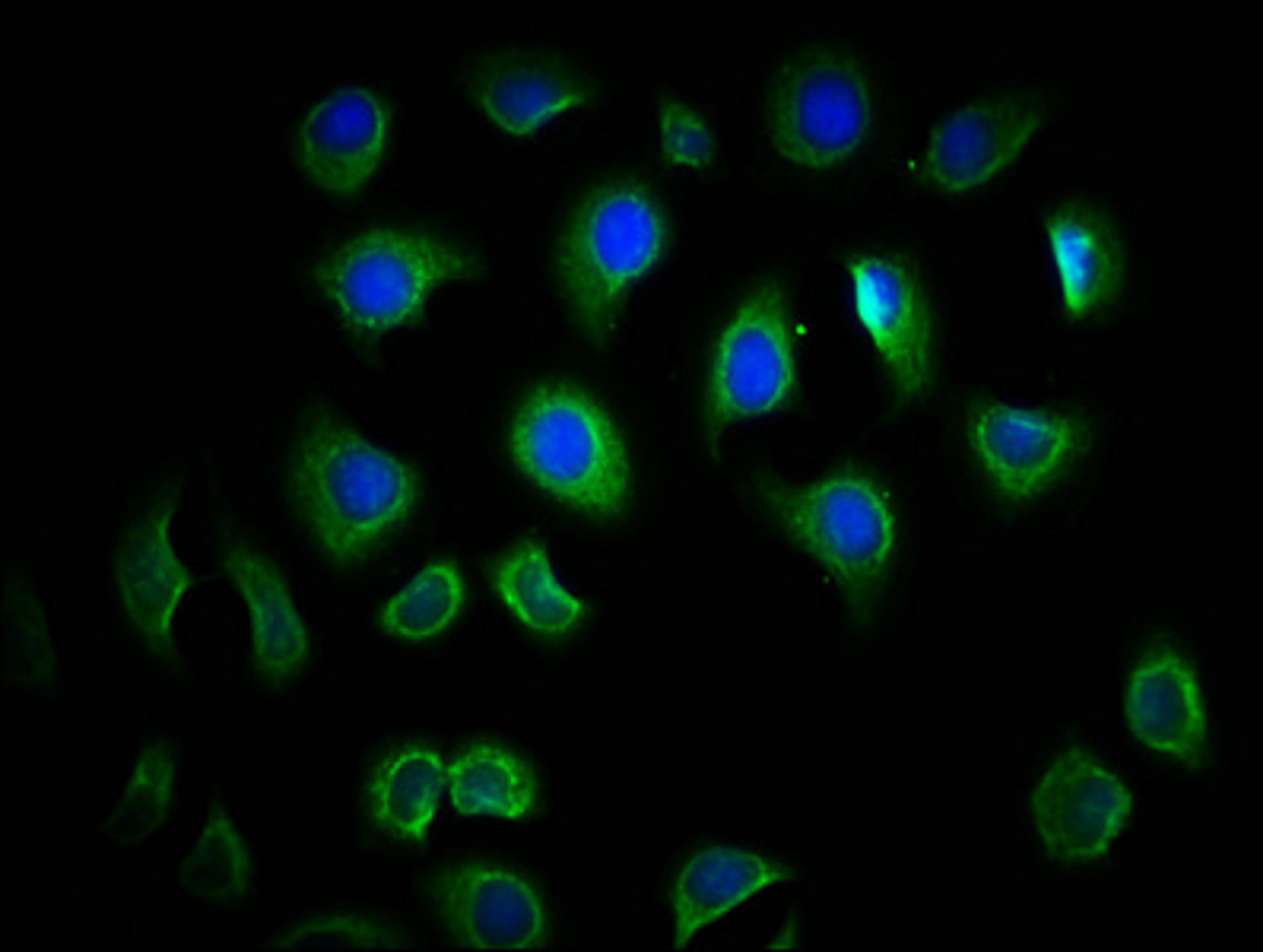 Immunofluorescence staining of A549 cells with CSB-PA023605LA01HU at 1:166, counter-stained with DAPI. The cells were fixed in 4% formaldehyde, permeabilized using 0.2% Triton X-100 and blocked in 10% normal Goat Serum. The cells were then incubated with the antibody overnight at 4&deg;C. The secondary antibody was Alexa Fluor 488-congugated AffiniPure Goat Anti-Rabbit IgG(H+L).