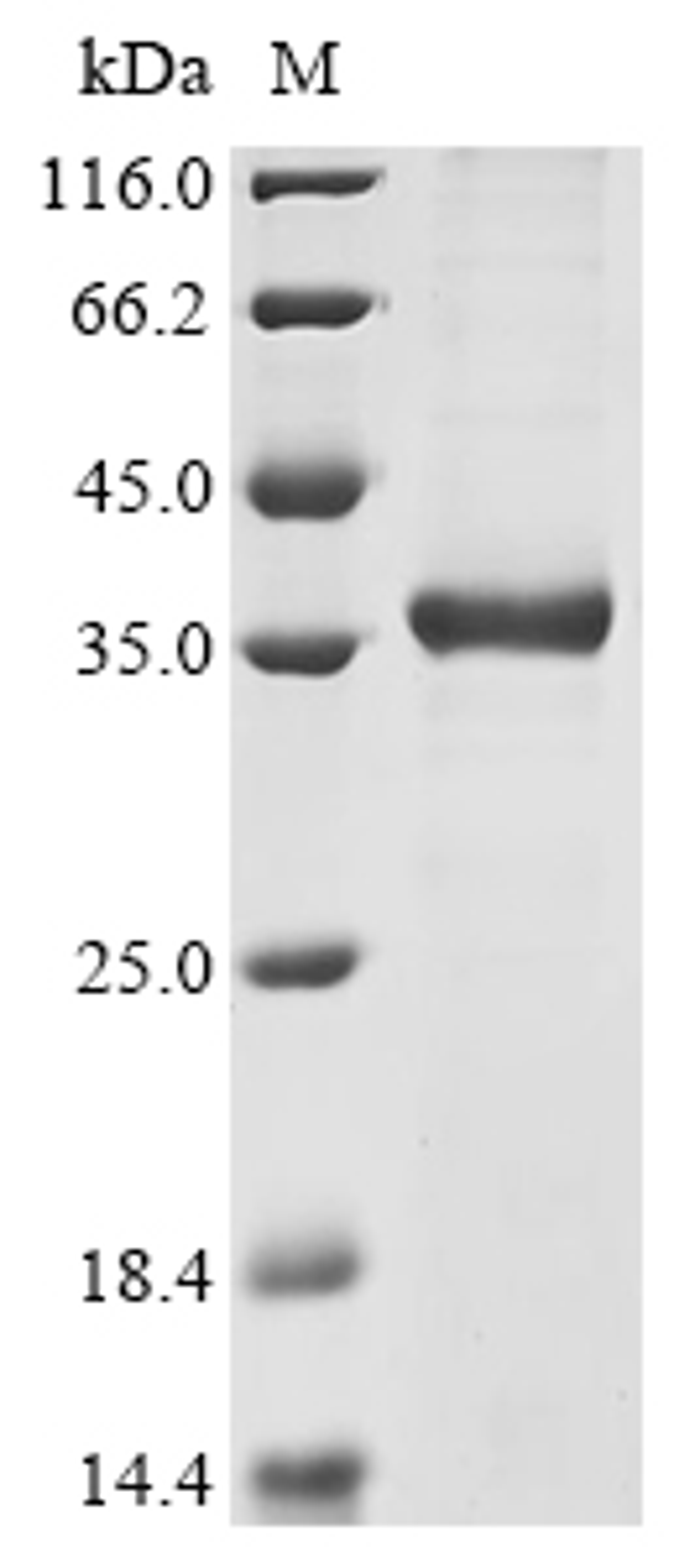 (Tris-Glycine gel) Discontinuous SDS-PAGE (reduced) with 5% enrichment gel and 15% separation gel.