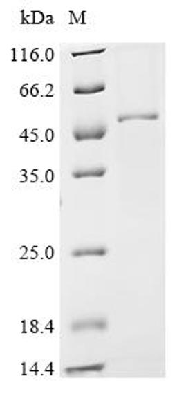 (Tris-Glycine gel) Discontinuous SDS-PAGE (reduced) with 5% enrichment gel and 15% separation gel.