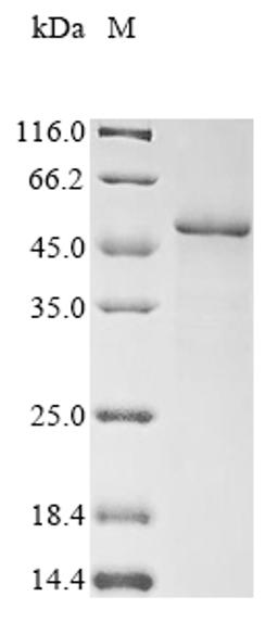 (Tris-Glycine gel) Discontinuous SDS-PAGE (reduced) with 5% enrichment gel and 15% separation gel.