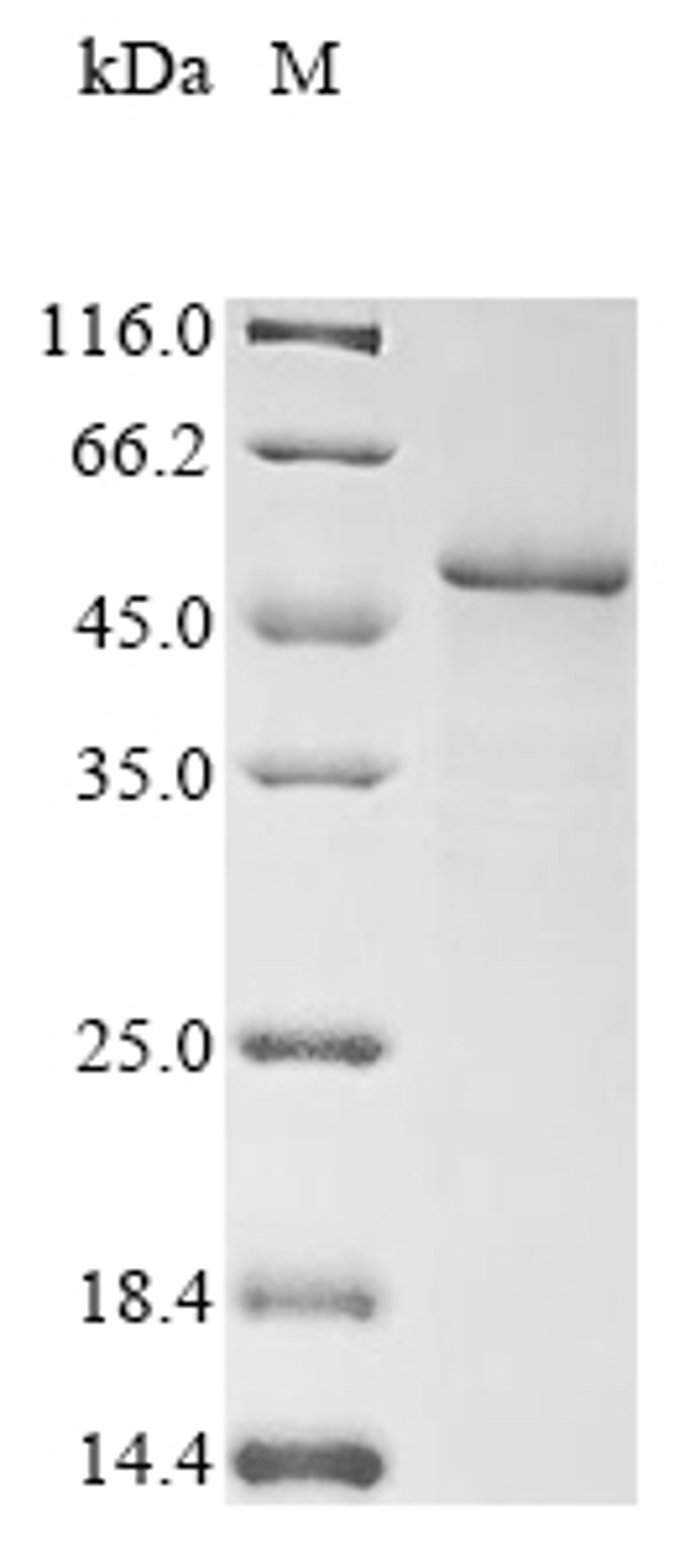 (Tris-Glycine gel) Discontinuous SDS-PAGE (reduced) with 5% enrichment gel and 15% separation gel.