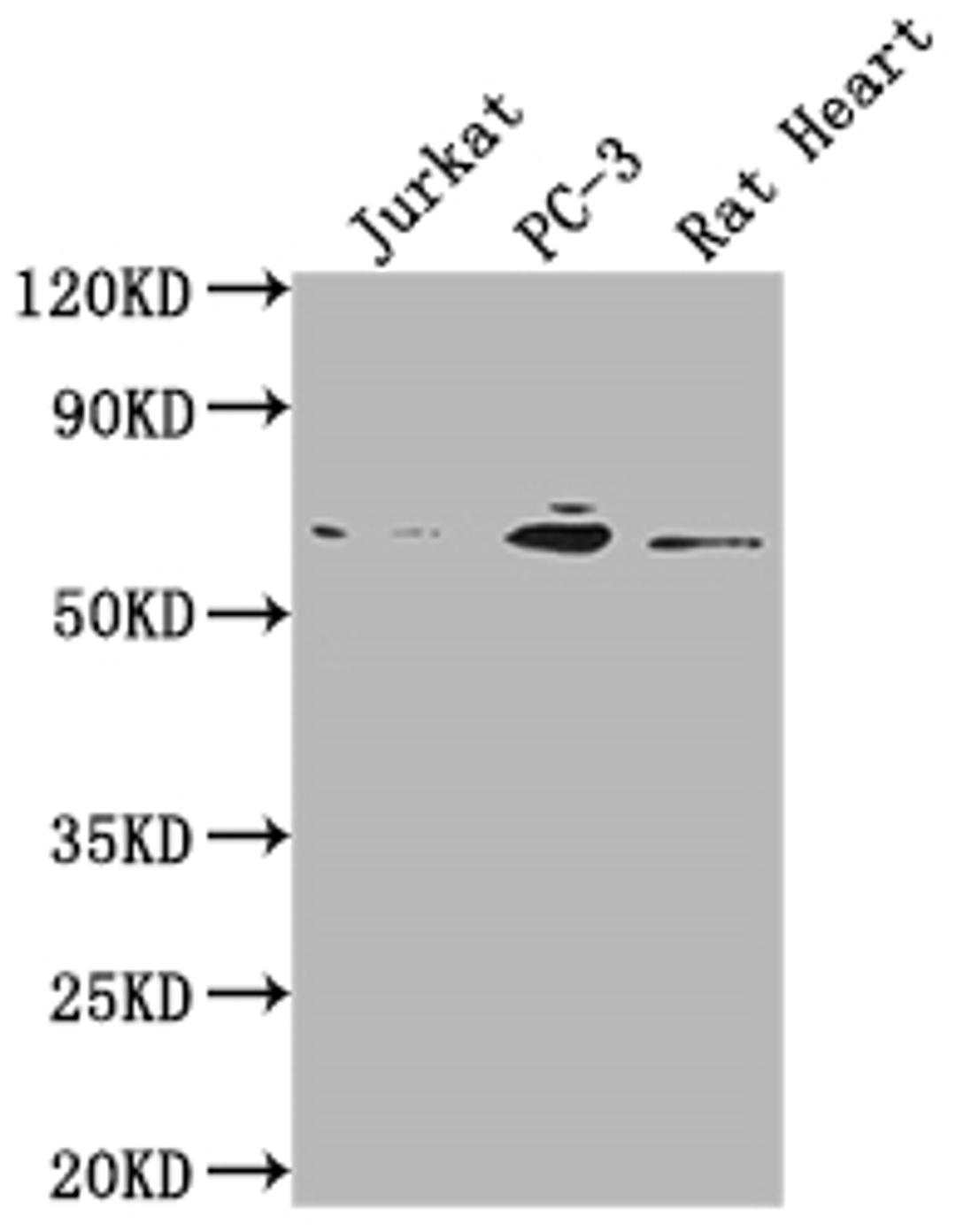 Western Blot. Positive WB detected in: Jurkat whole cell lysate, PC-3 whole cell lysate, Rat Heart tissue. All lanes: E2F1 antibody at 1:2000. Secondary. Goat polyclonal to rabbit IgG at 1/50000 dilution. Predicted band size: 47 kDa. Observed band size: 60 kDa. 