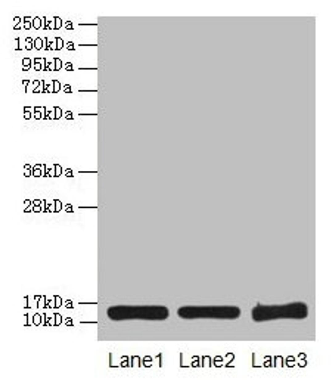 Western blot. All lanes: SNCG antibody at 16µg/ml. Lane 1: HT29 whole cell lysate. Lane 2: Mouse brain tissue. Lane 3: 293T whole cell lysate. Secondary. Goat polyclonal to rabbit IgG at 1/10000 dilution. Predicted band size: 14 kDa. Observed band size: 14 kDa