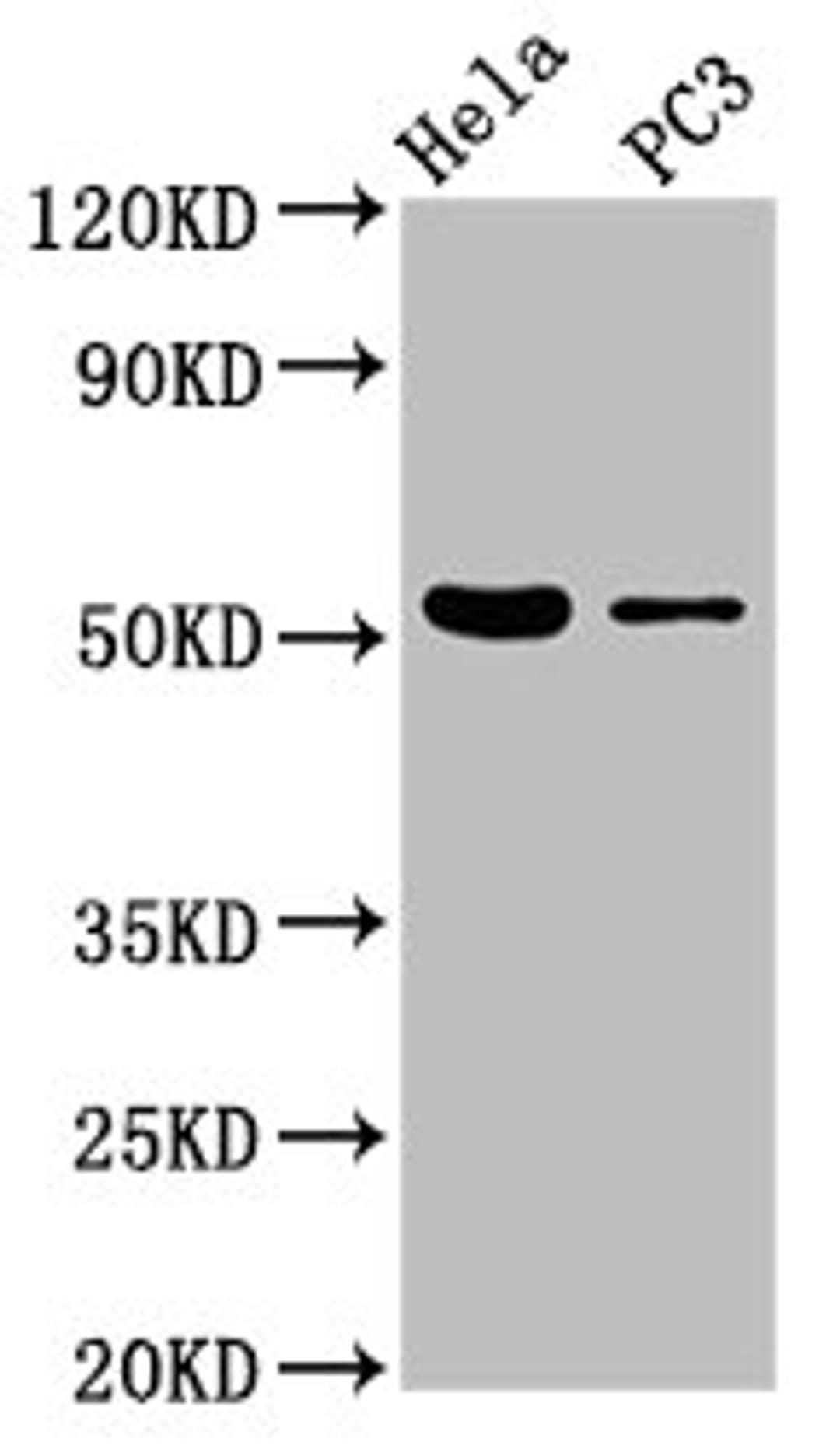 Western Blot. Positive WB detected in: Hela whole cell lysate, PC-3 whole cell lysate. All lanes: CELF6 antibody at 3.7µg/ml. Secondary. Goat polyclonal to rabbit IgG at 1/50000 dilution. Predicted band size: 51, 39, 48, 37 kDa. Observed band size: 51 kDa