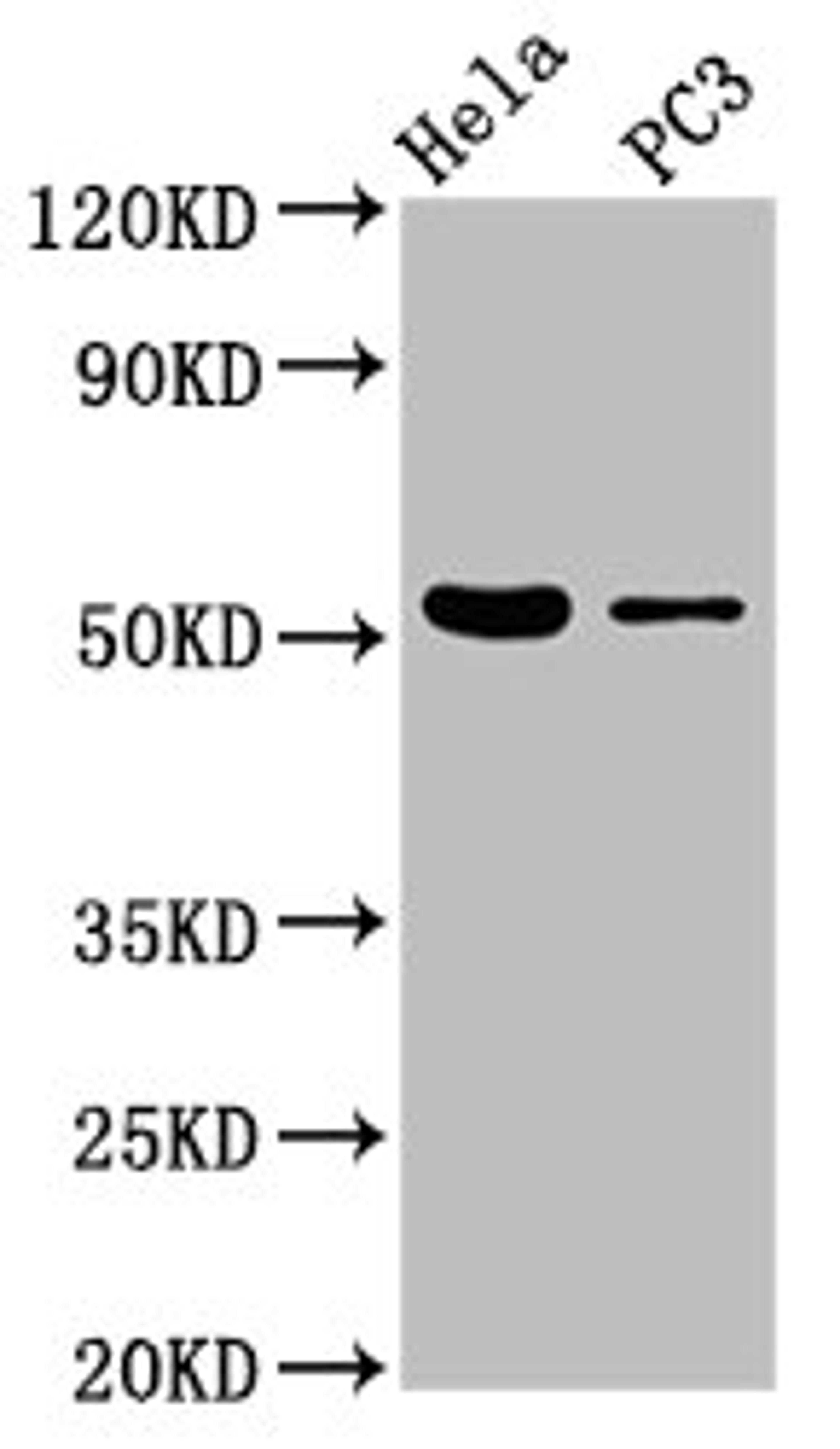 Western Blot. Positive WB detected in: Hela whole cell lysate, PC-3 whole cell lysate. All lanes: CELF6 antibody at 3.7µg/ml. Secondary. Goat polyclonal to rabbit IgG at 1/50000 dilution. Predicted band size: 51, 39, 48, 37 kDa. Observed band size: 51 kDa